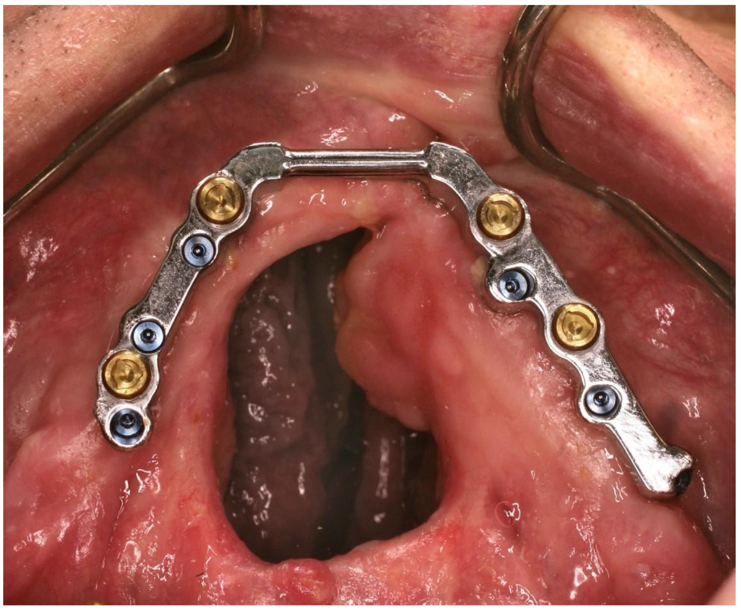 Dentistry 11 00212 g001