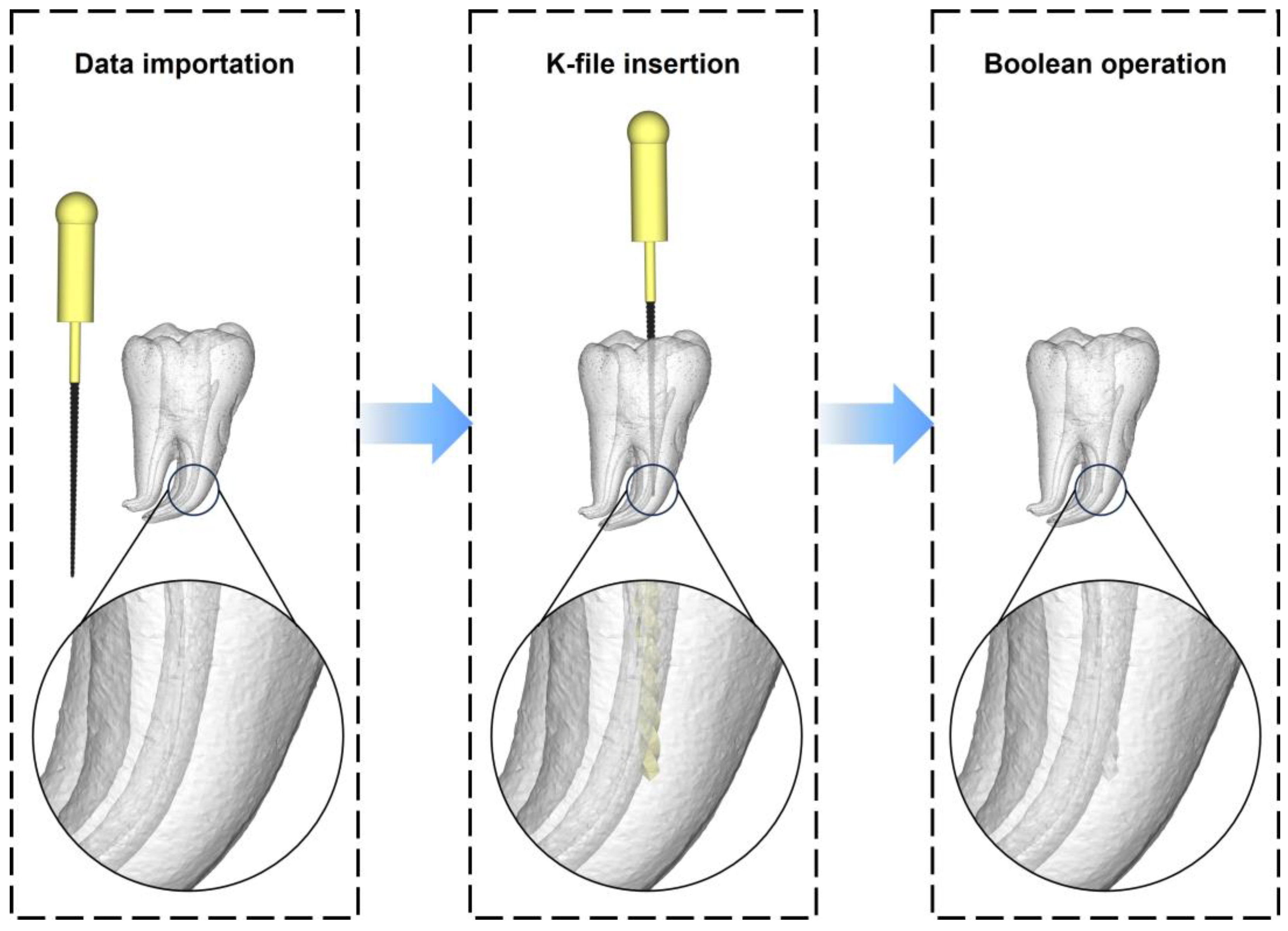 Dentistry 11 00213 g003