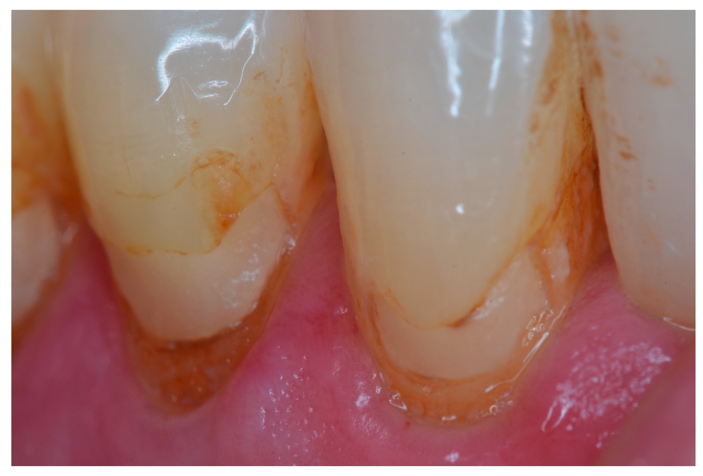 Dentistry 11 00225 g003