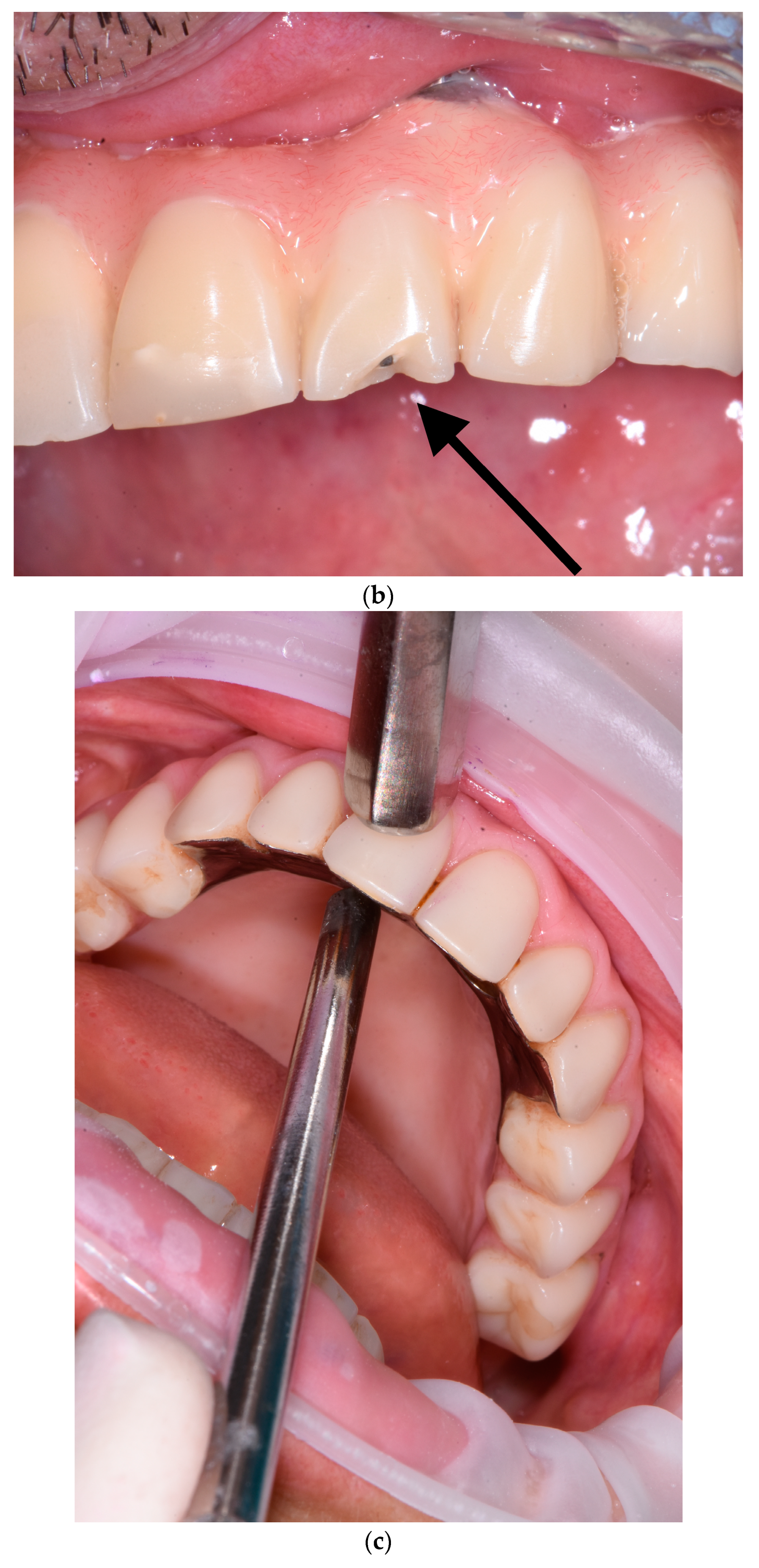 Dentistry 11 00226 g006b