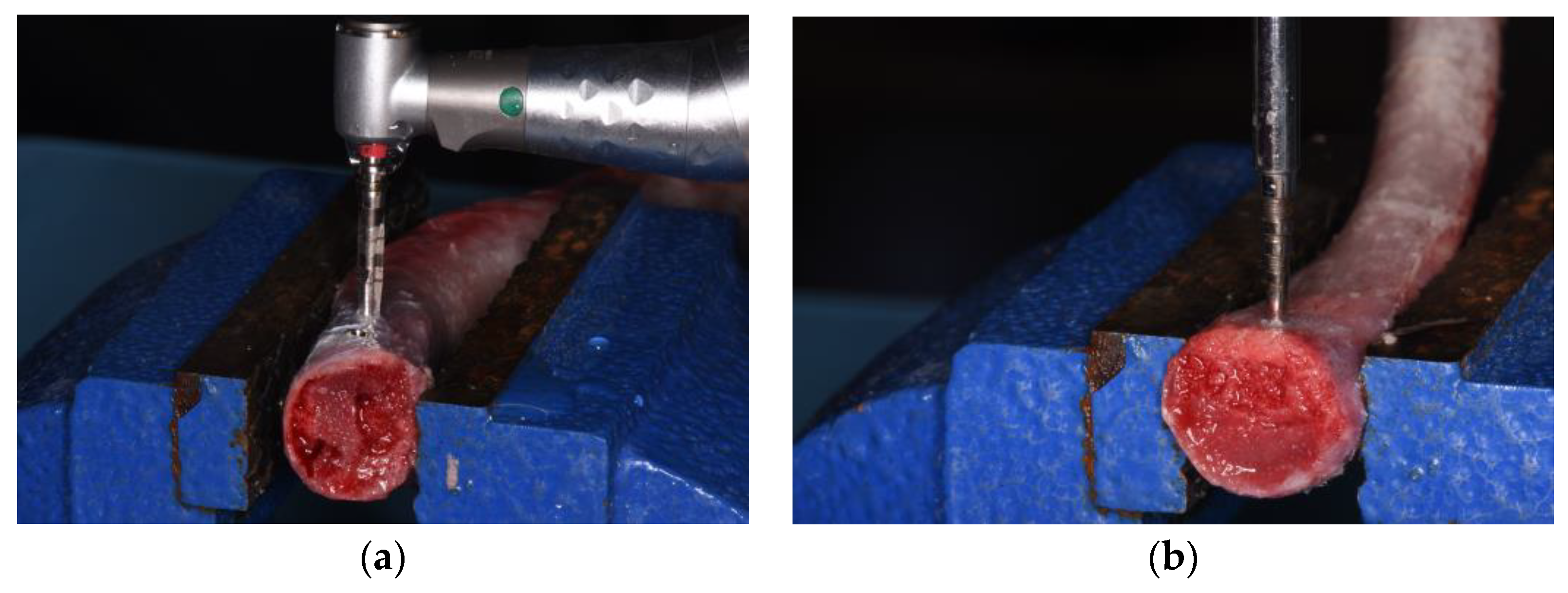 Dentistry 11 00227 g002