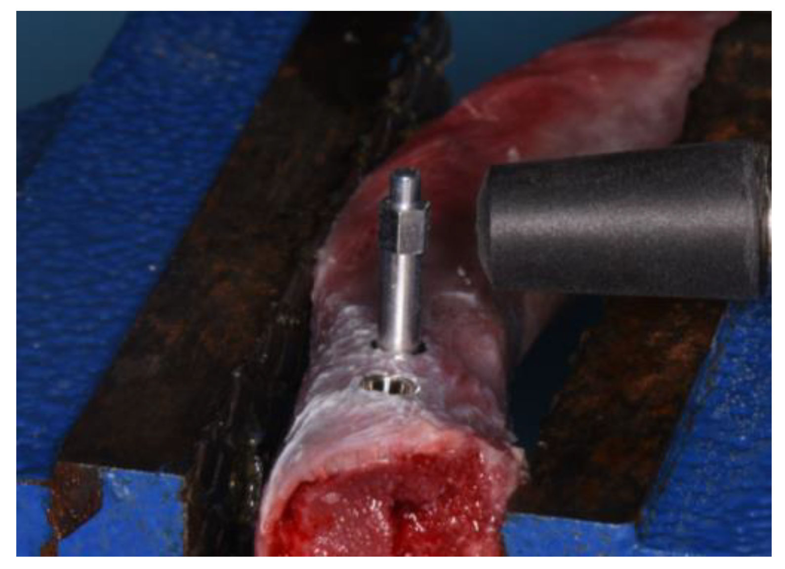 Dentistry 11 00227 g004