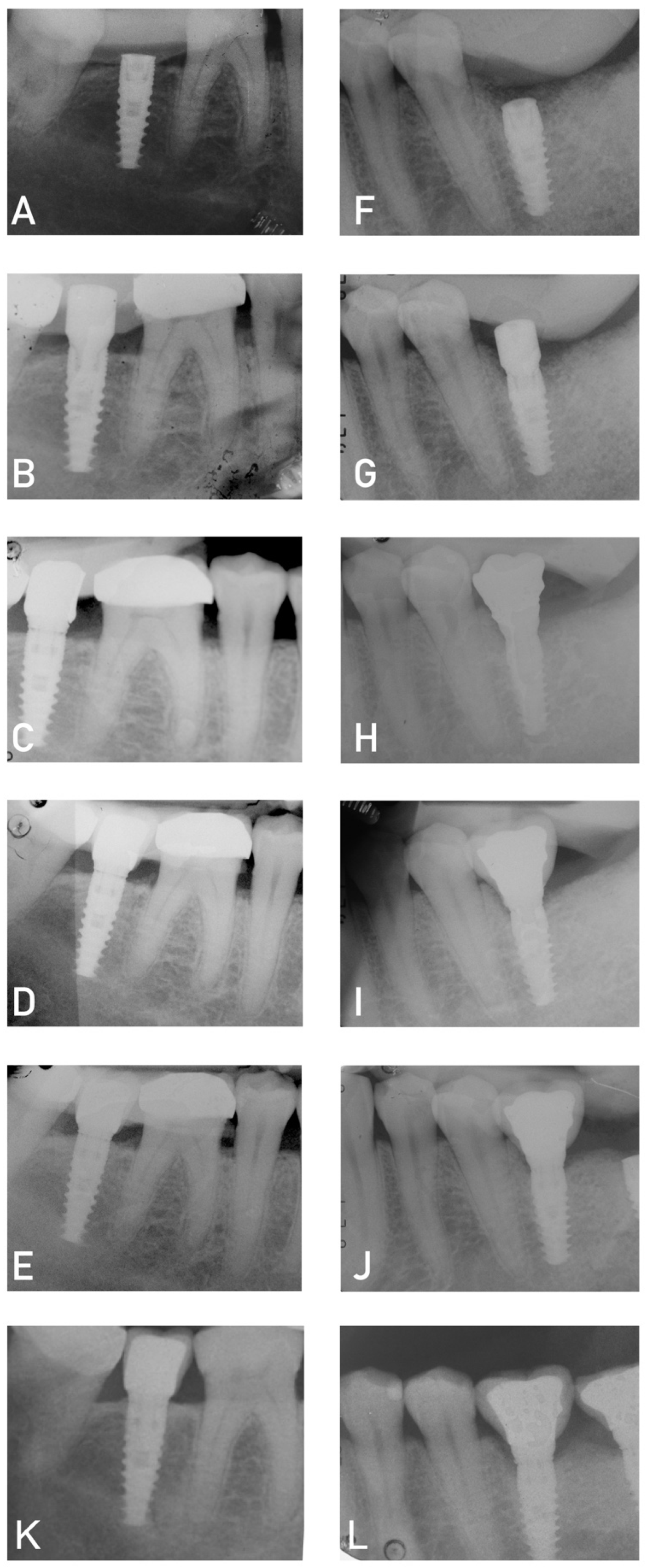 Dentistry 11 00228 g004