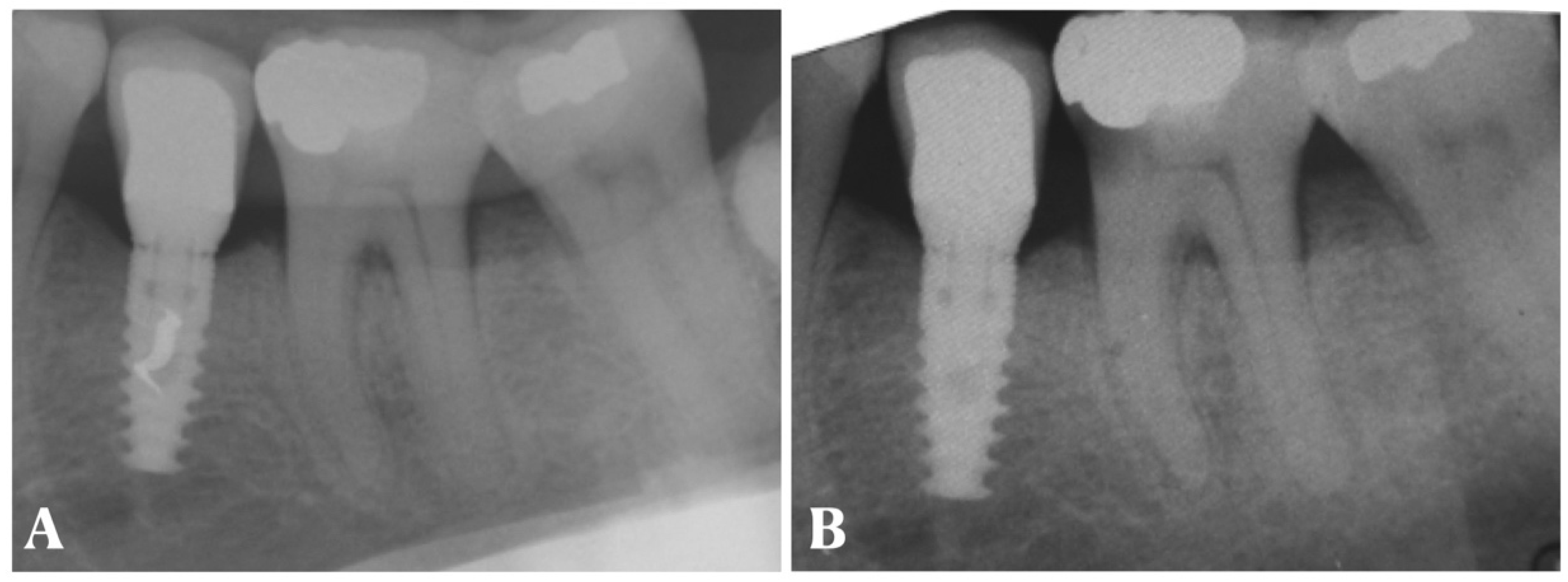 Dentistry 11 00228 g005