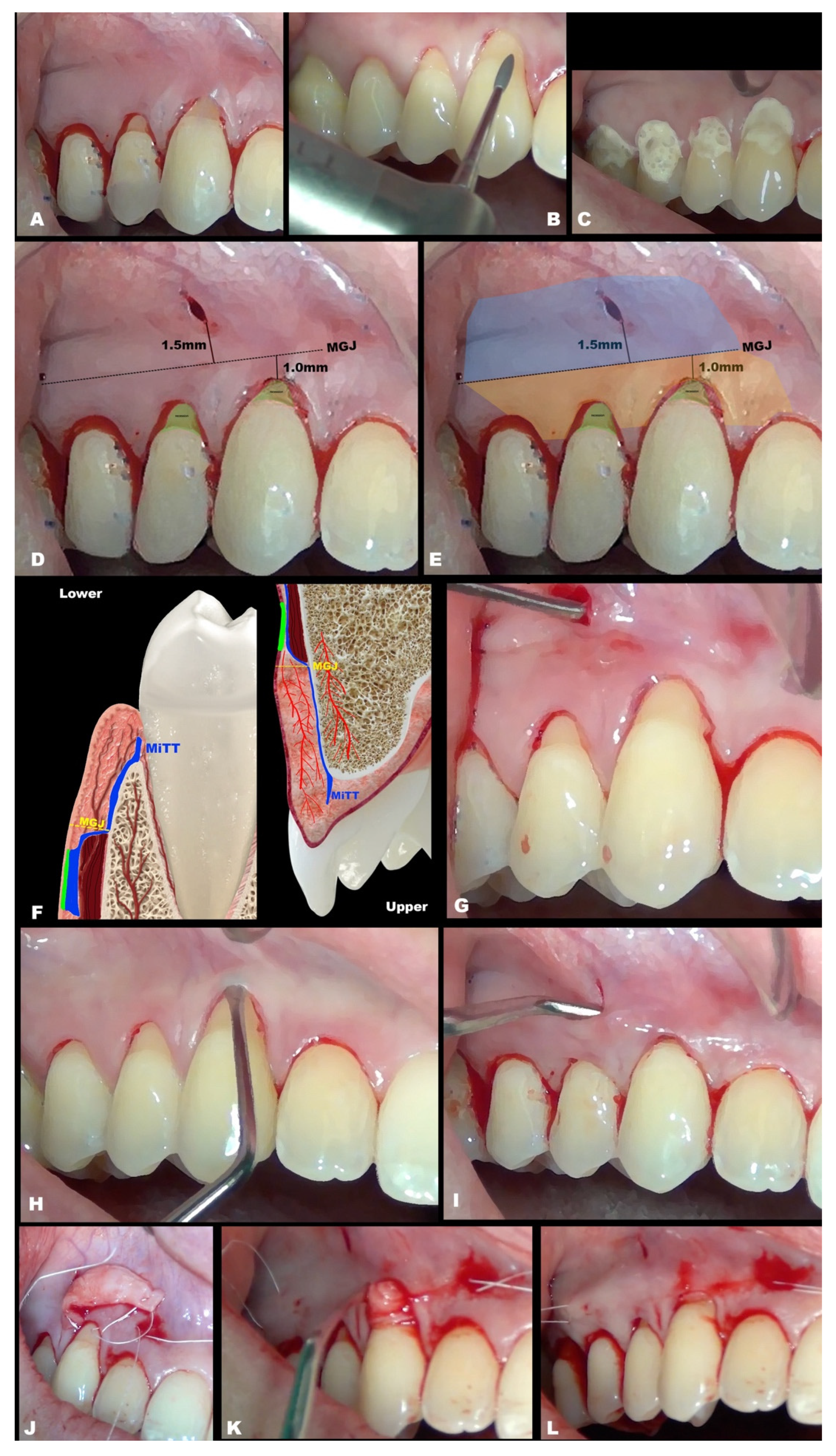 Dentistry 11 00235 g001