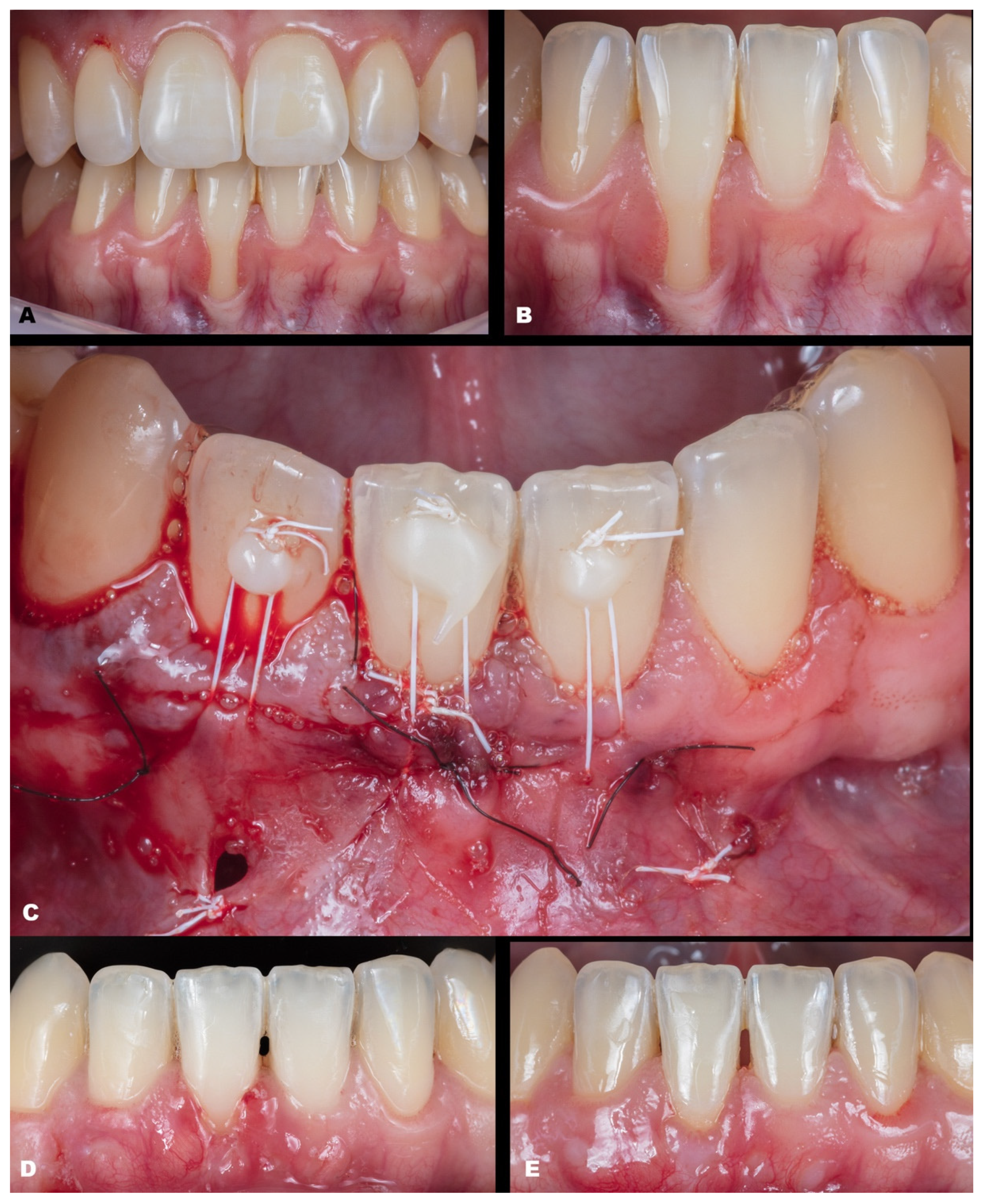 Dentistry 11 00235 g002