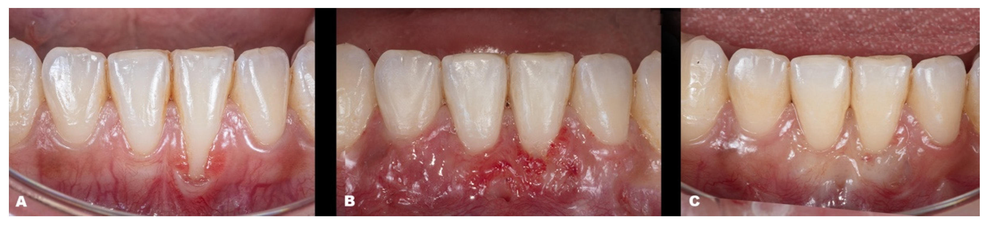 Dentistry 11 00235 g003