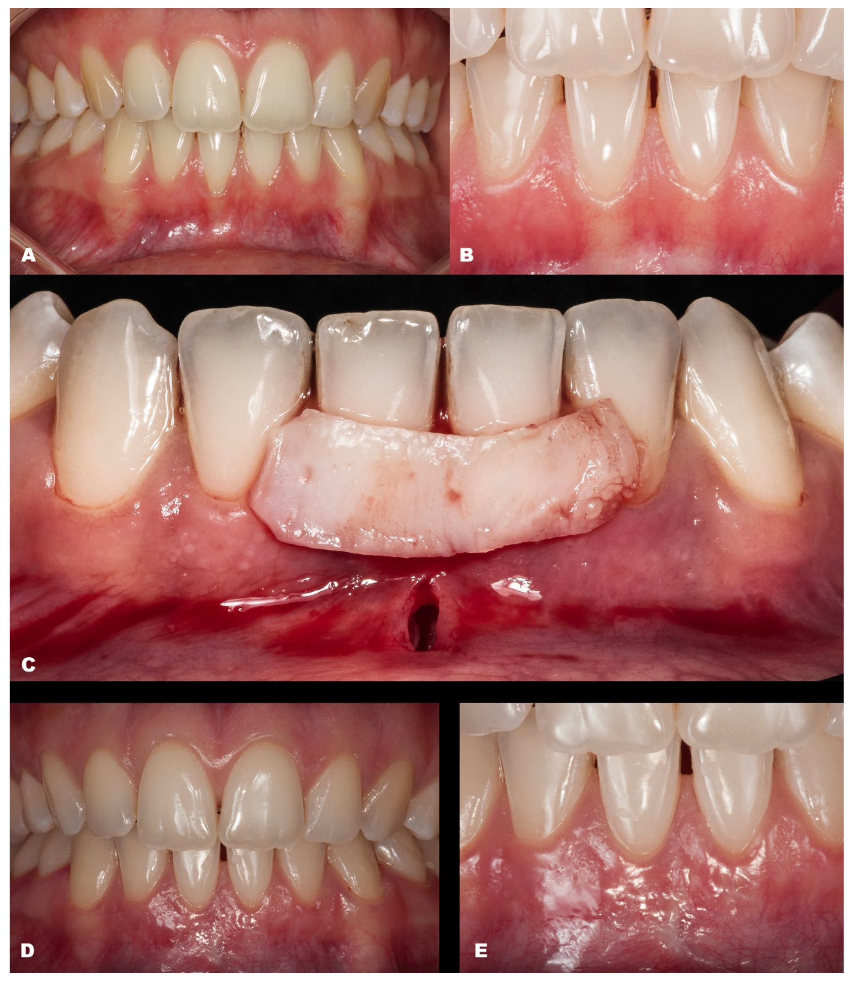 Dentistry 11 00235 g004