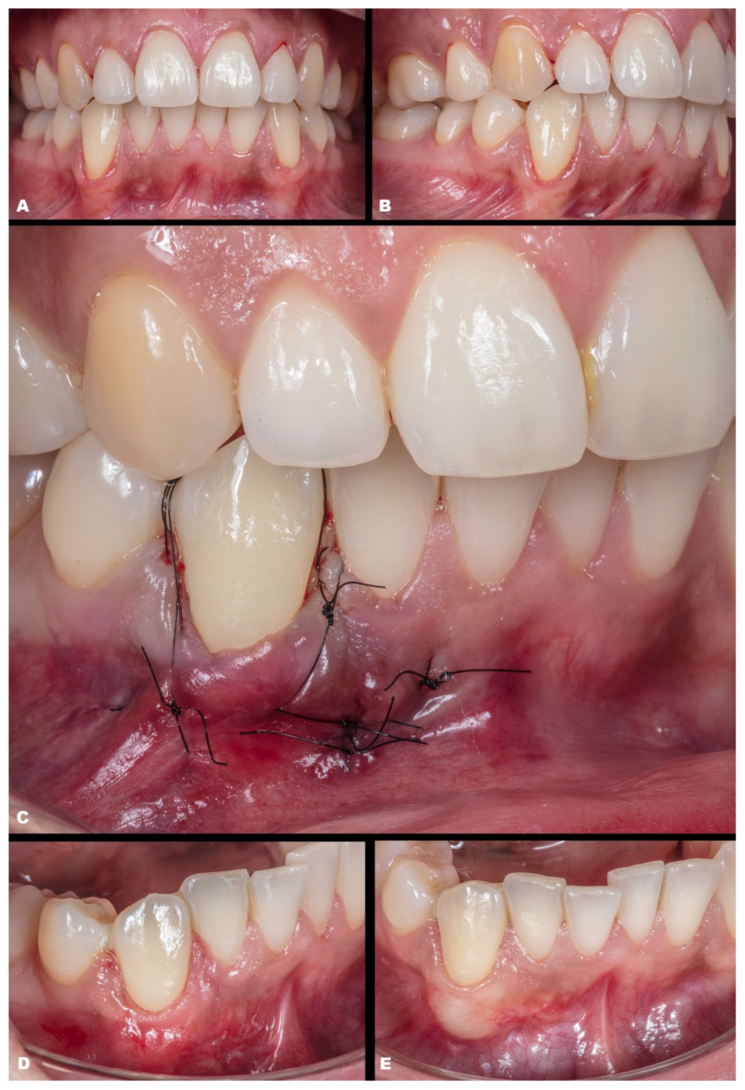 Dentistry 11 00235 g006