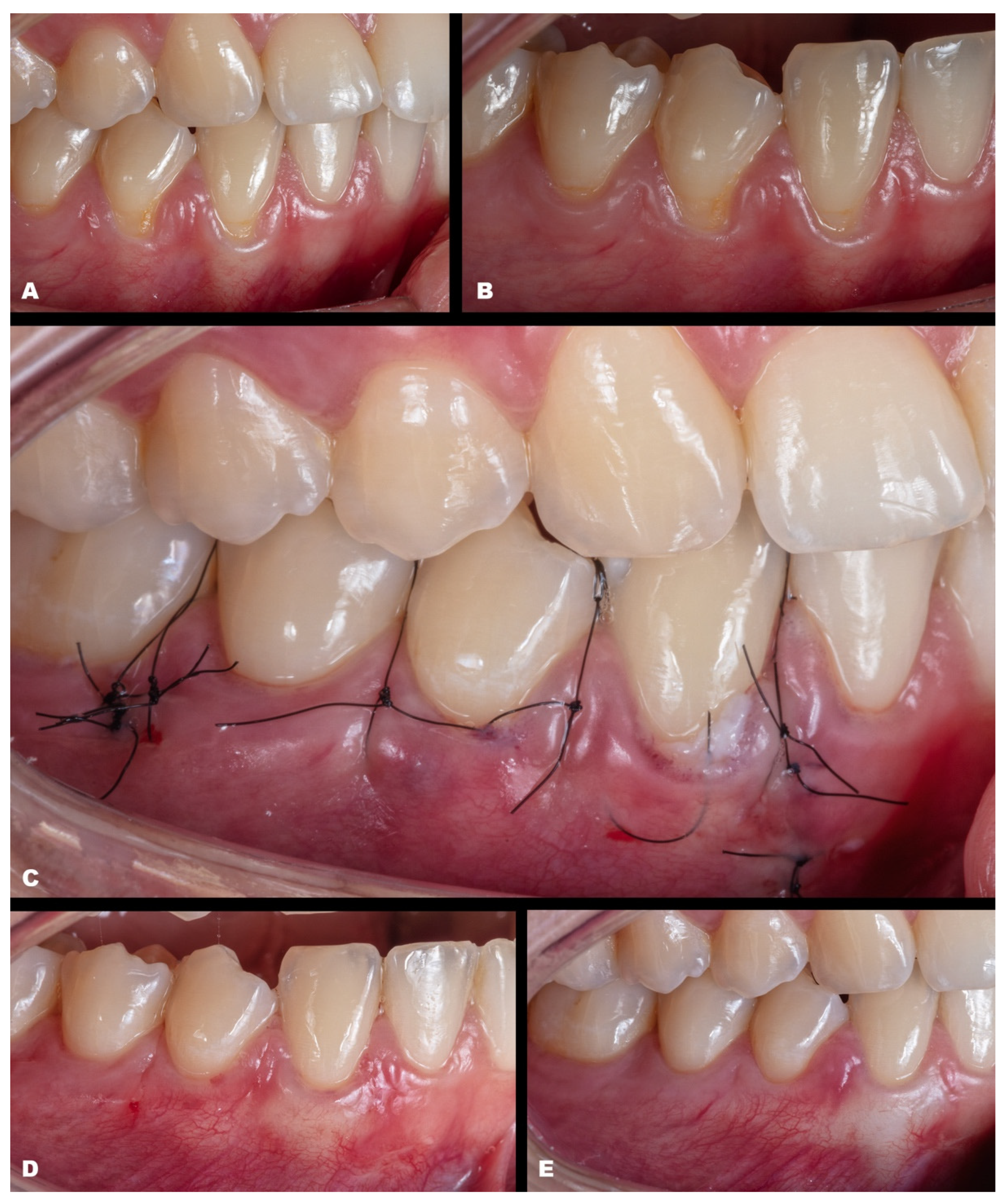 Dentistry 11 00235 g007