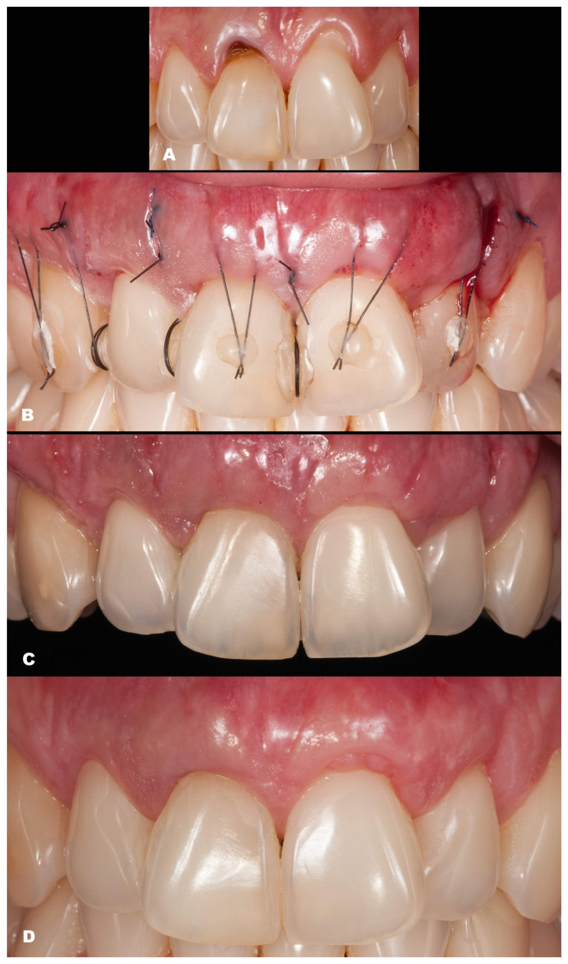 Dentistry 11 00235 g008