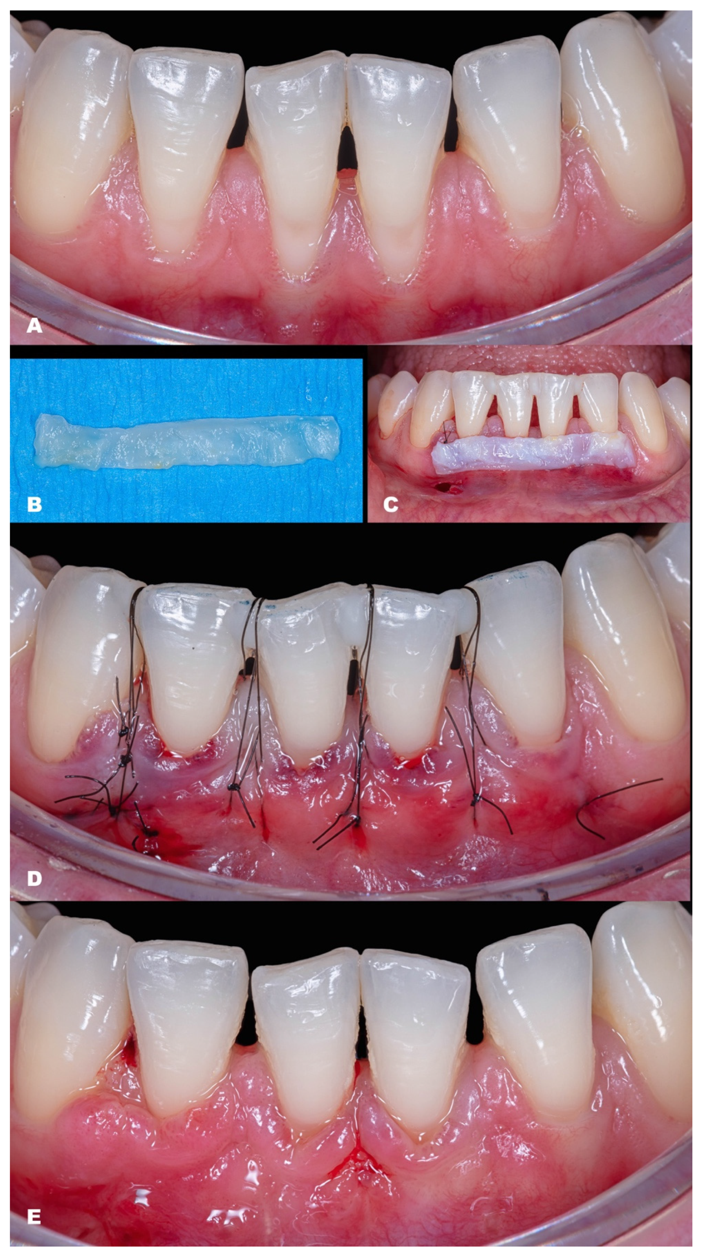 Dentistry 11 00235 g009