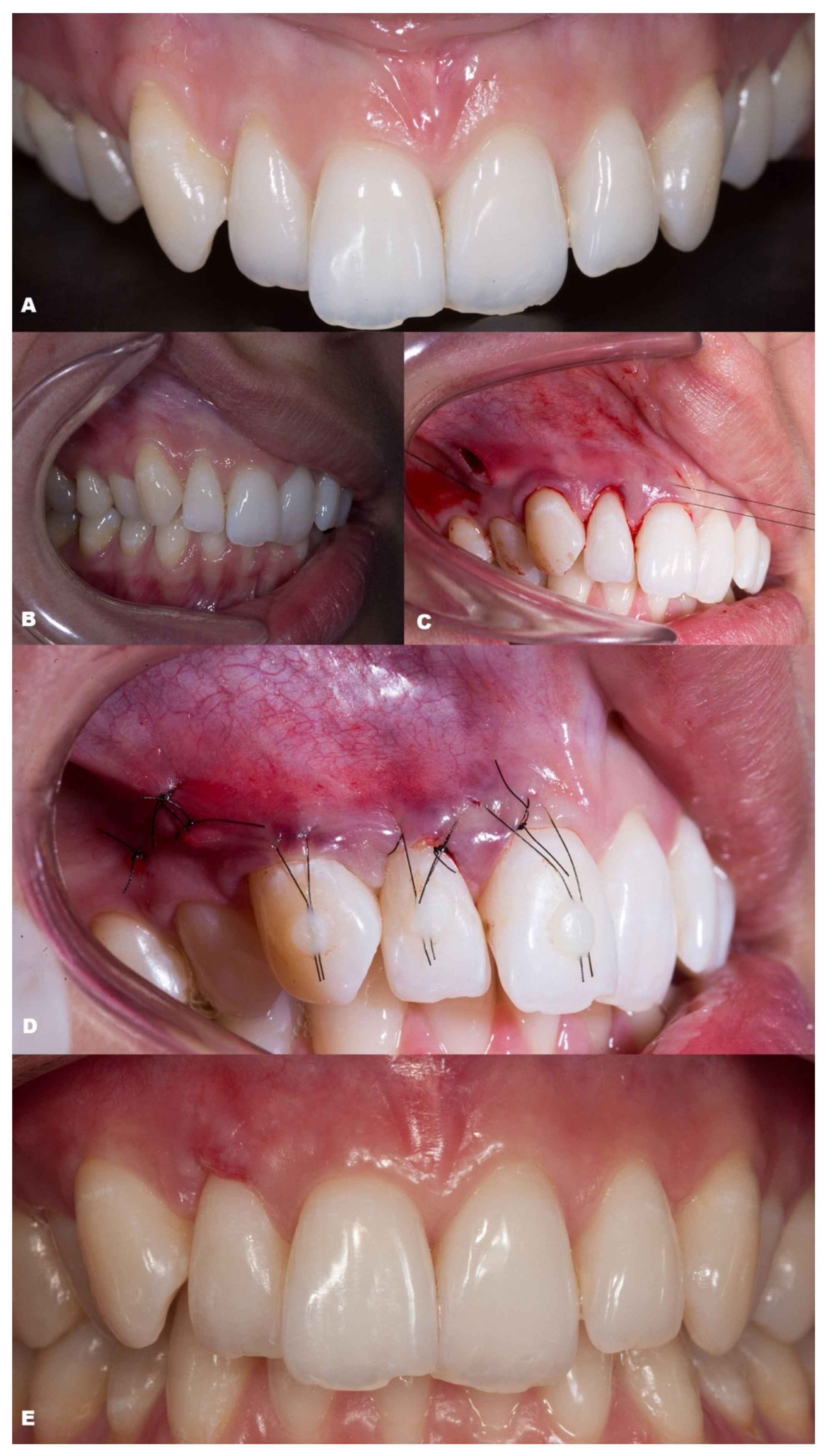 Dentistry 11 00235 g010