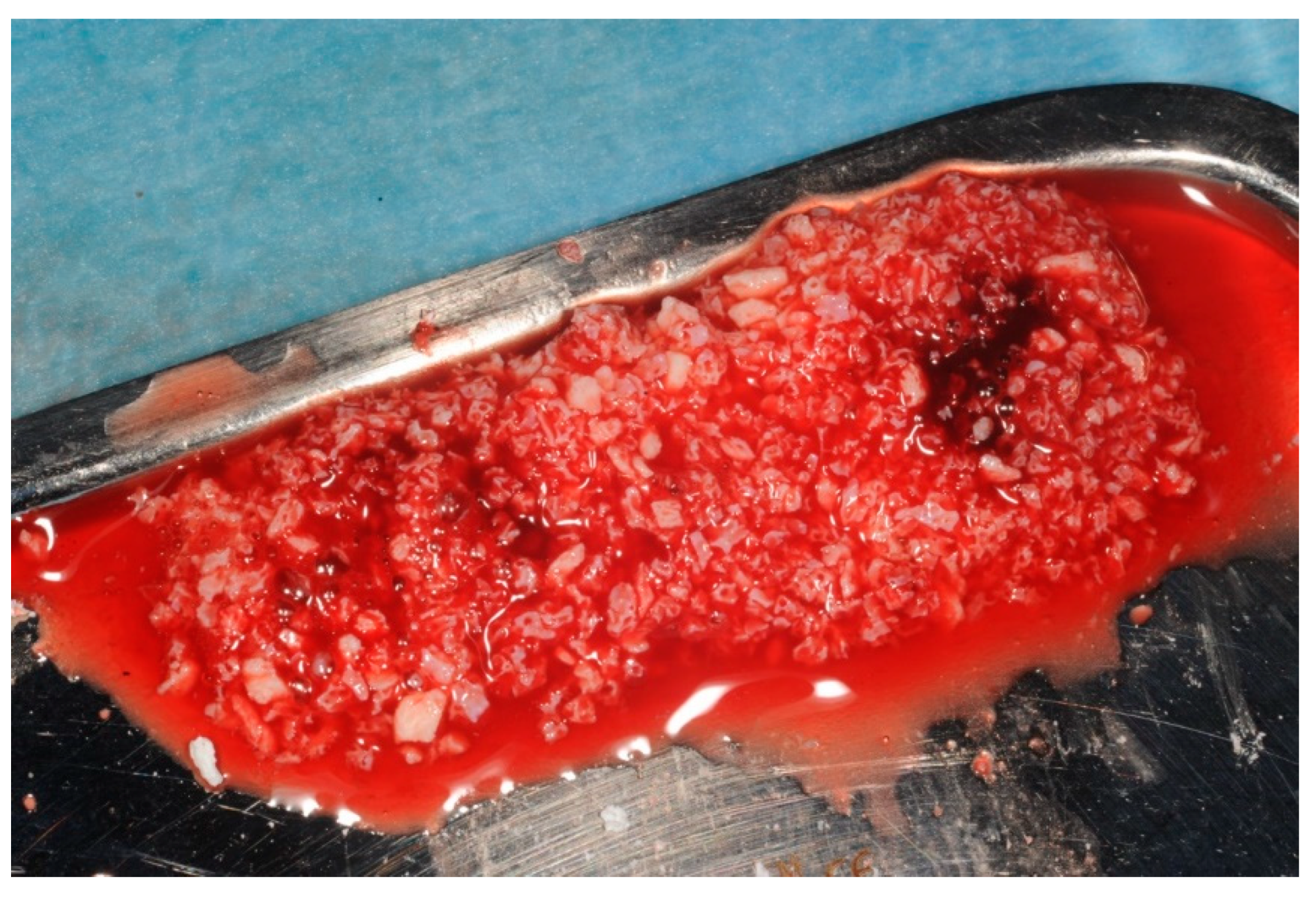 Dentistry 11 00244 g002