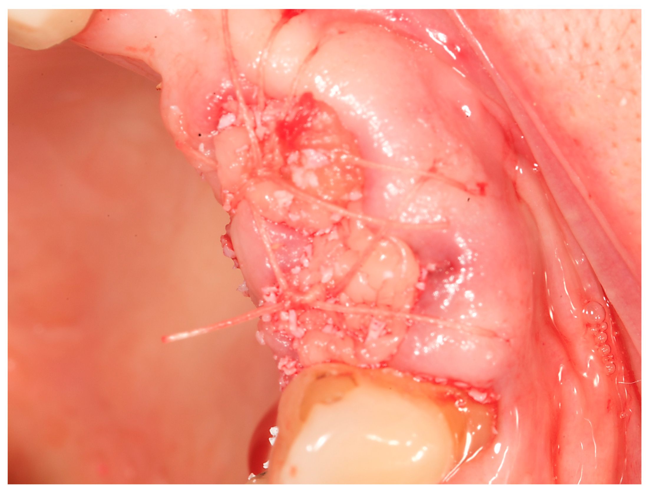 Dentistry 11 00244 g003a