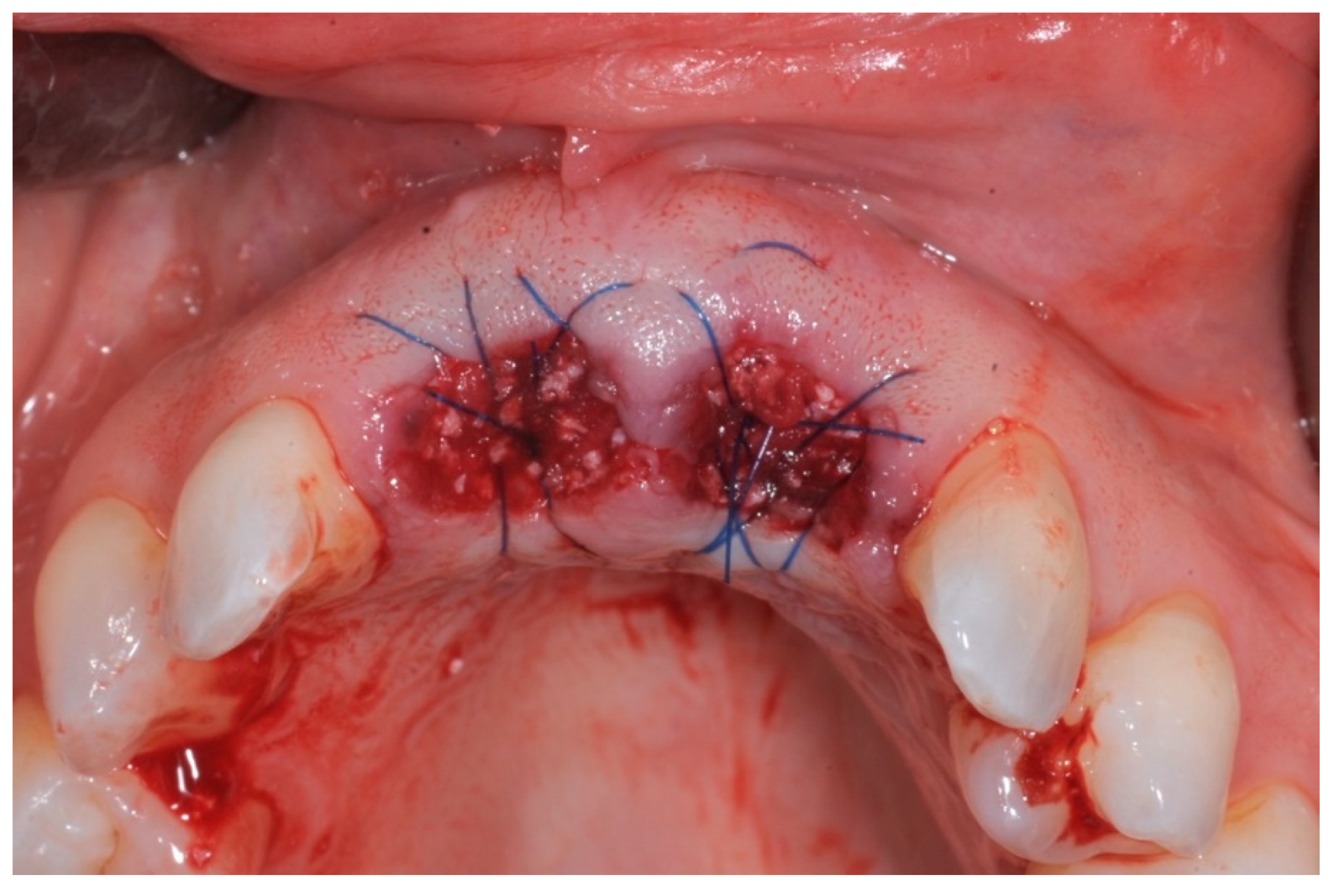 Dentistry 11 00244 g003b