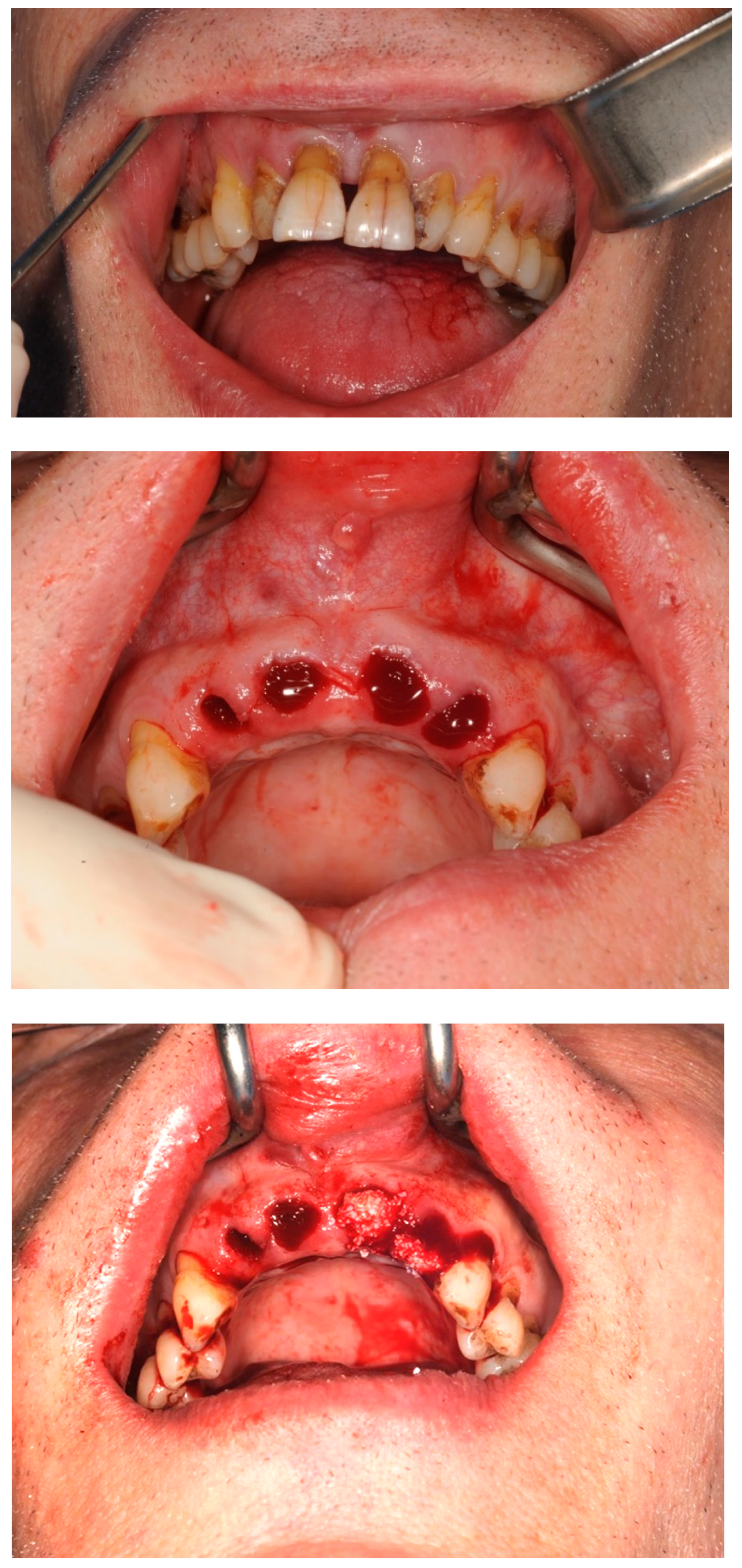 Dentistry 11 00244 g004a