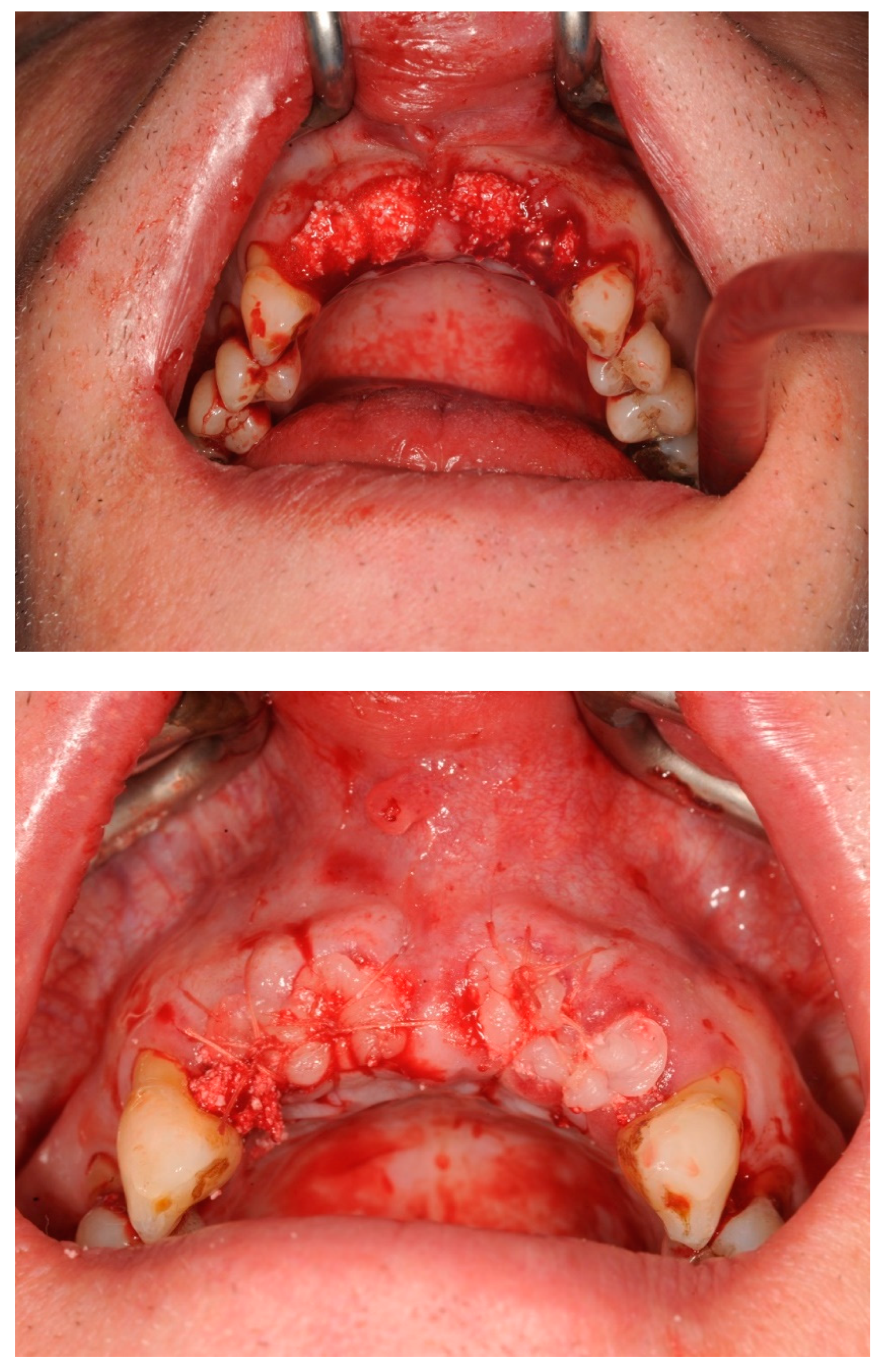 Dentistry 11 00244 g004b