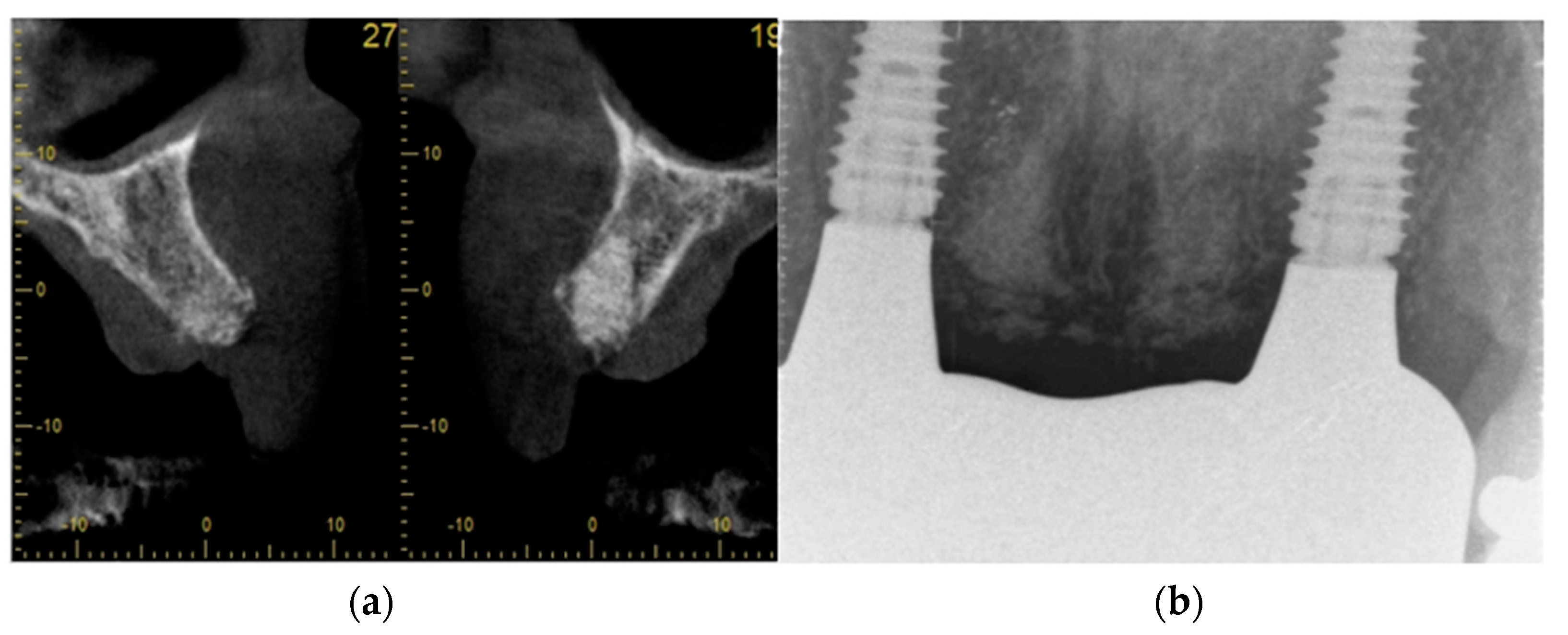 Dentistry 11 00244 g005