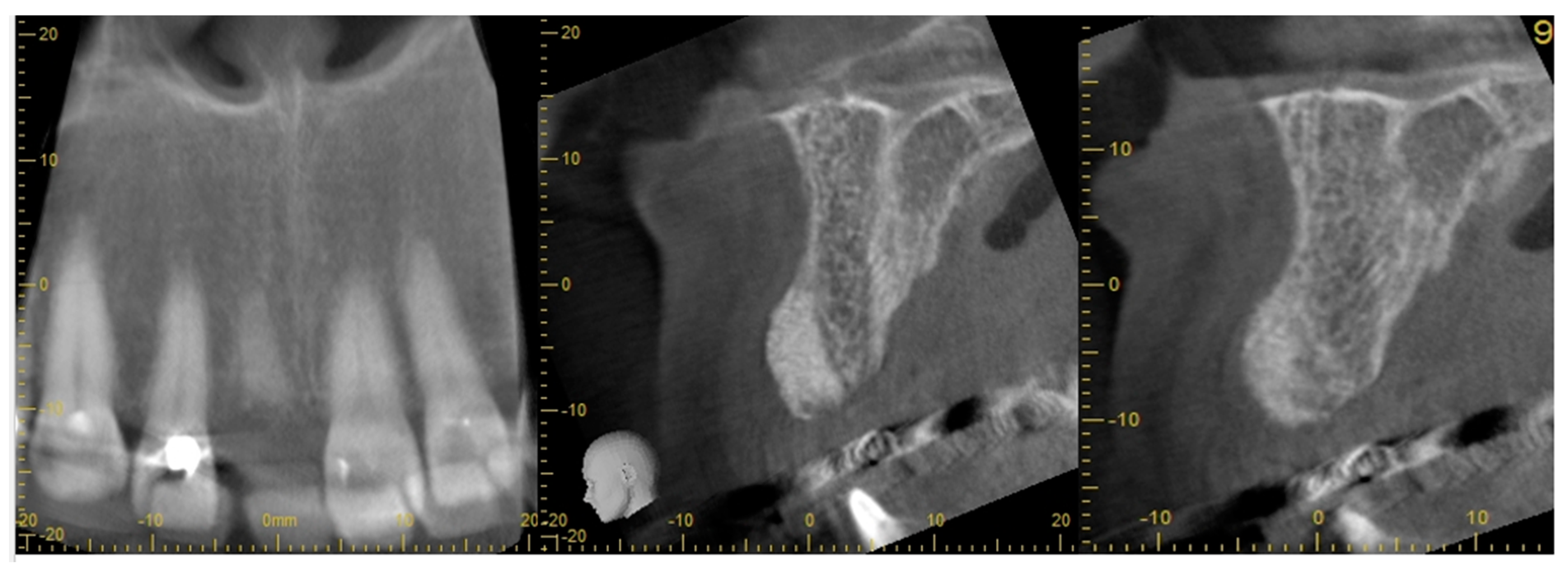 Dentistry 11 00244 g006