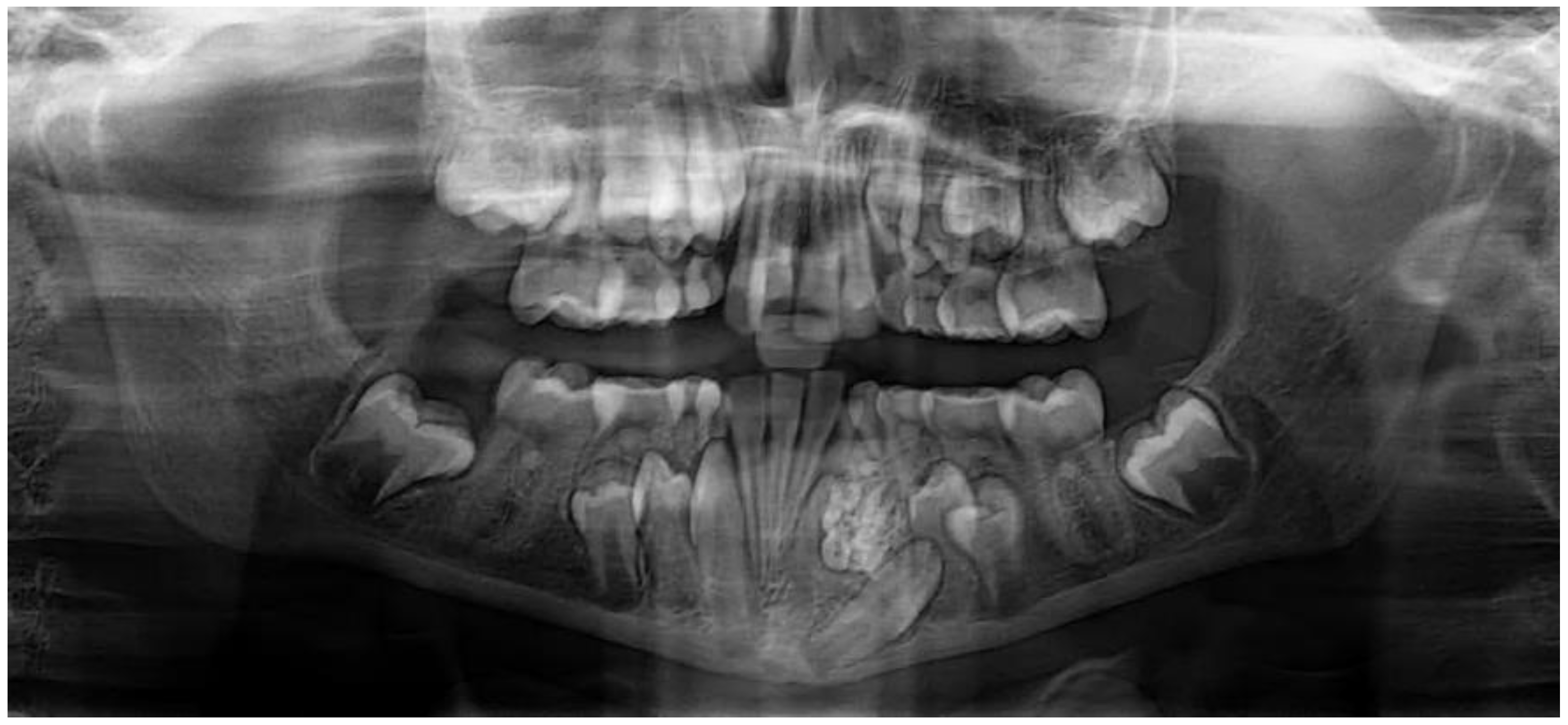 Dentistry 11 00253 g003