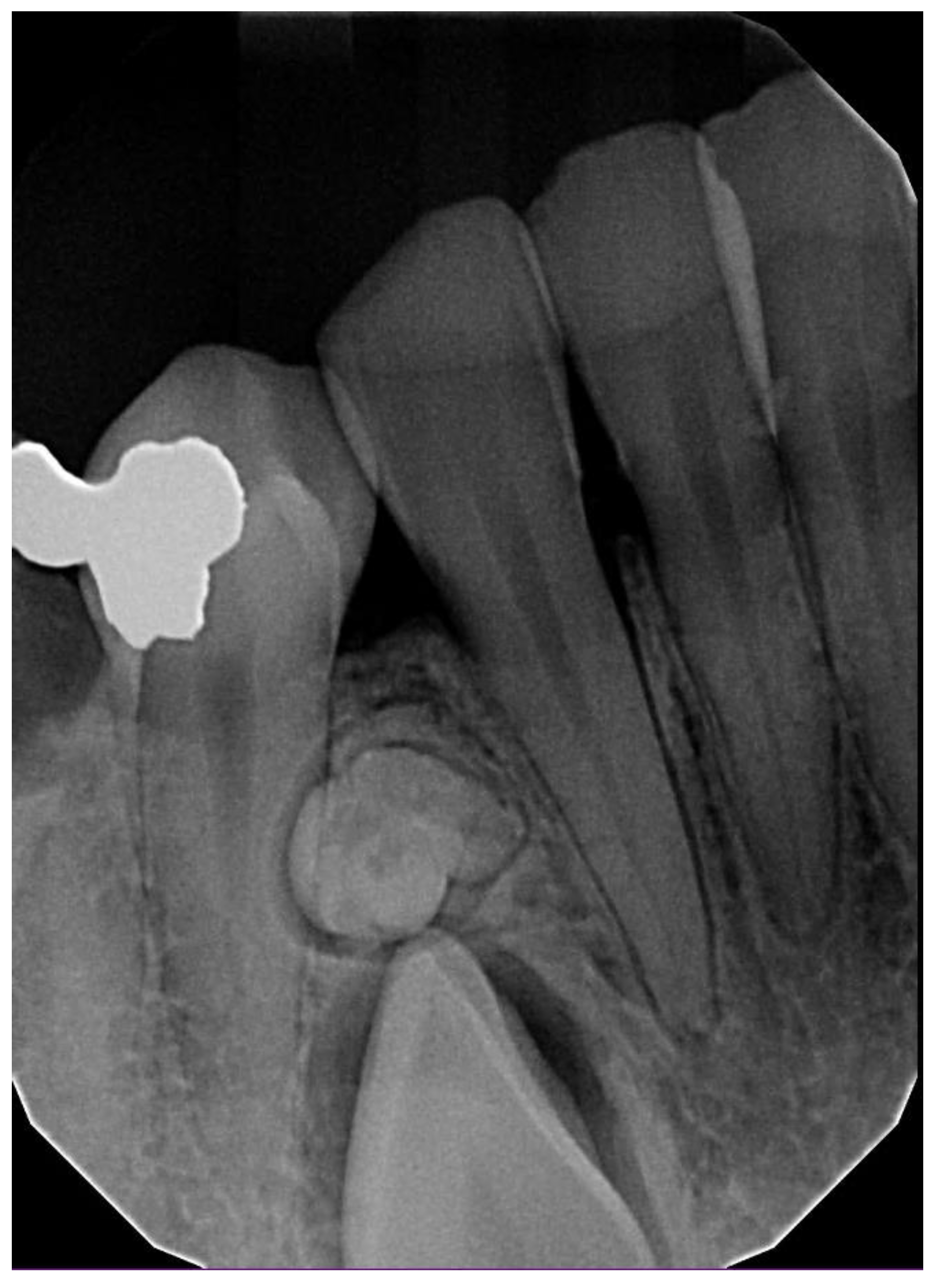 Dentistry 11 00253 g006