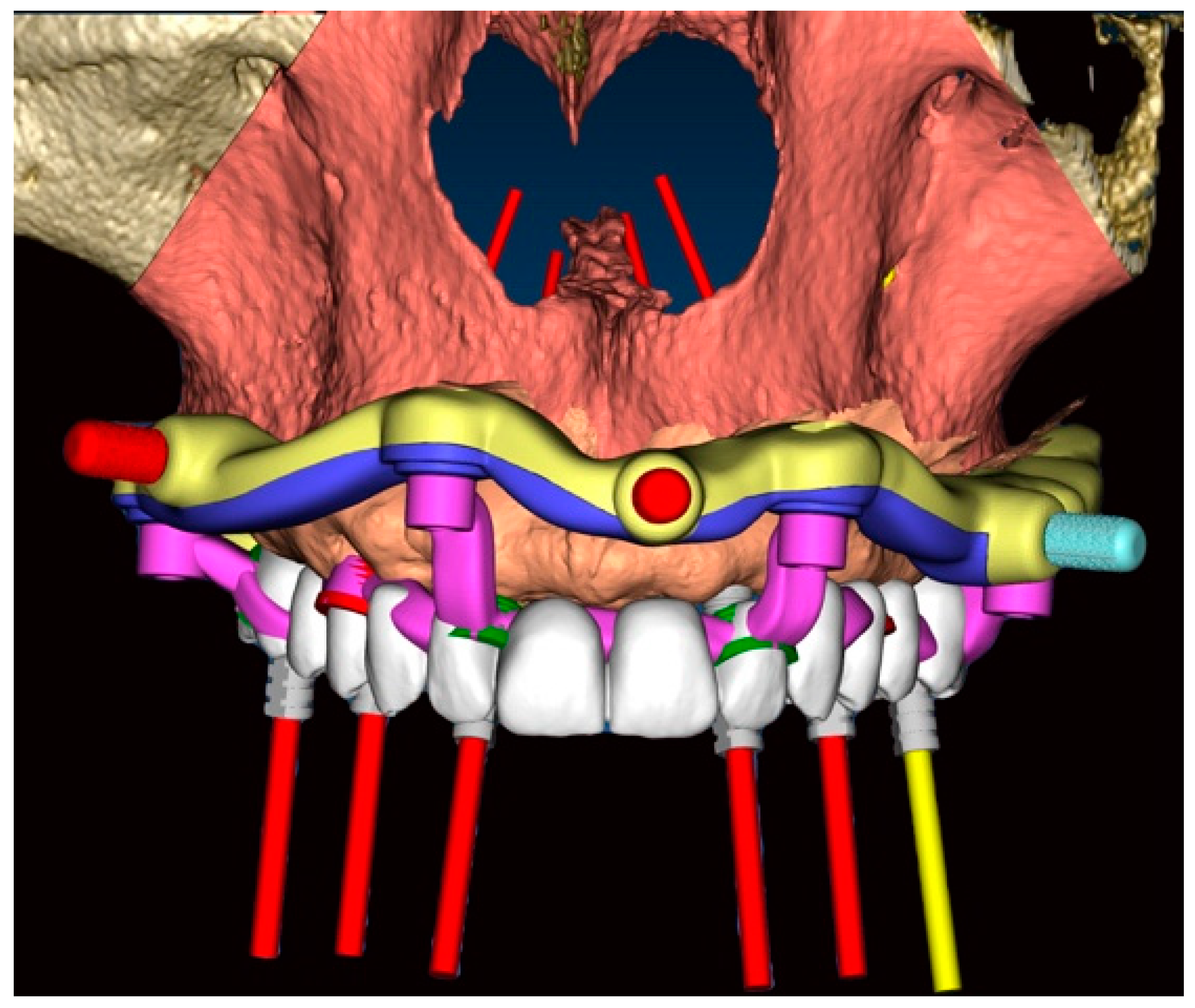 Dentistry 11 00256 g004