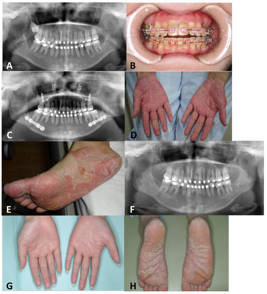 Dentistry Journal Free FullText Skin Symptoms That Appeared after