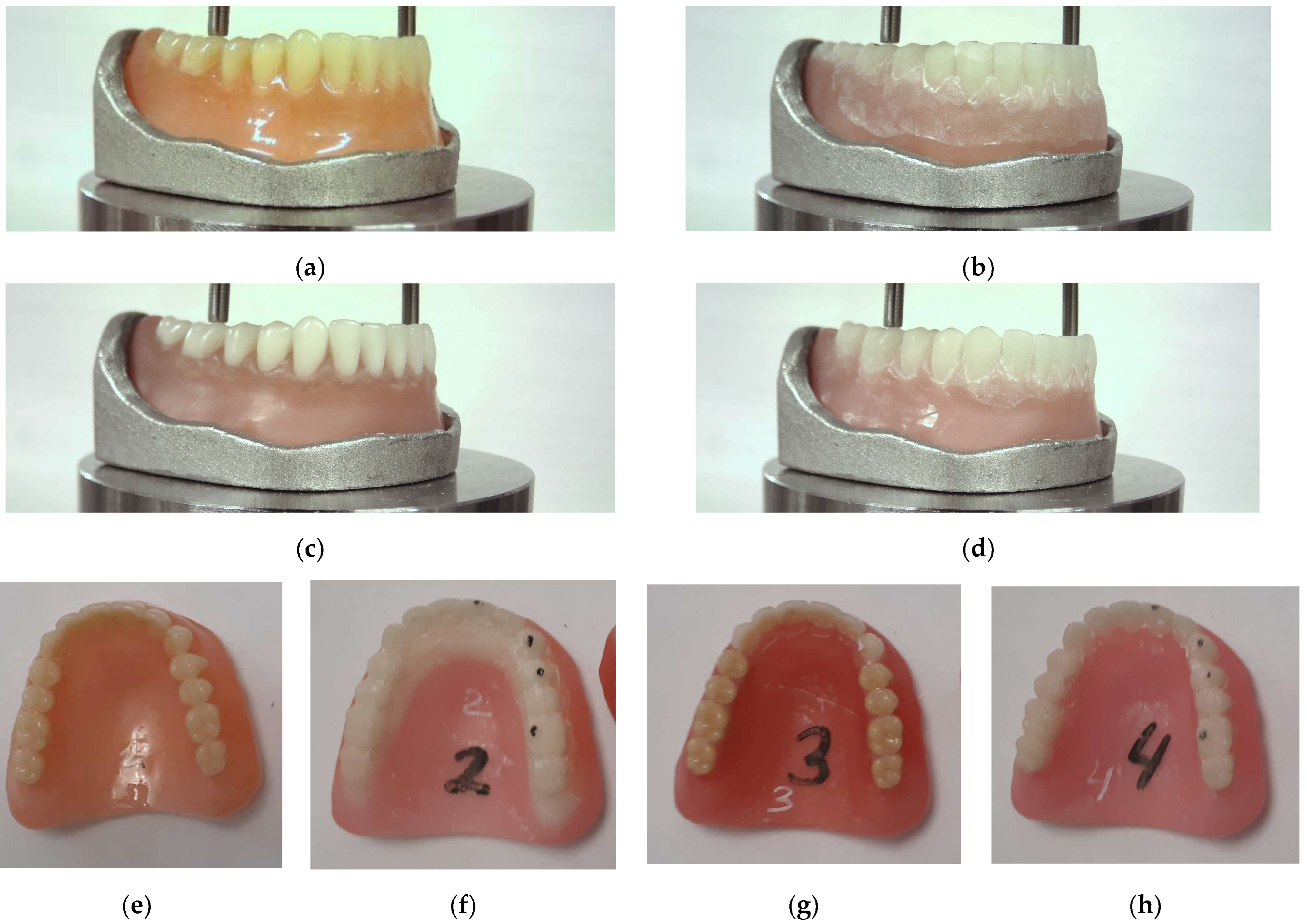 Ranking Technologies of Additive Manufacturing of Removable 