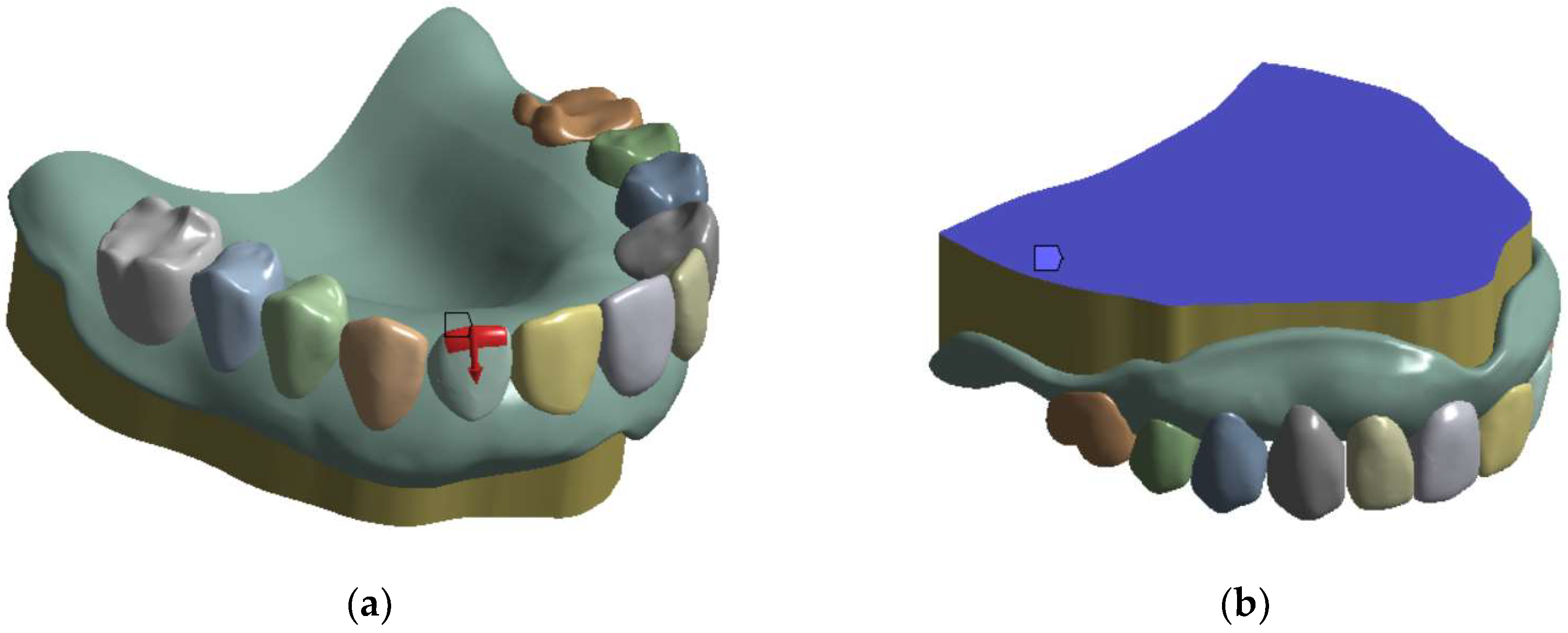 Dentistry Journal Free FullText Ranking Technologies of Additive