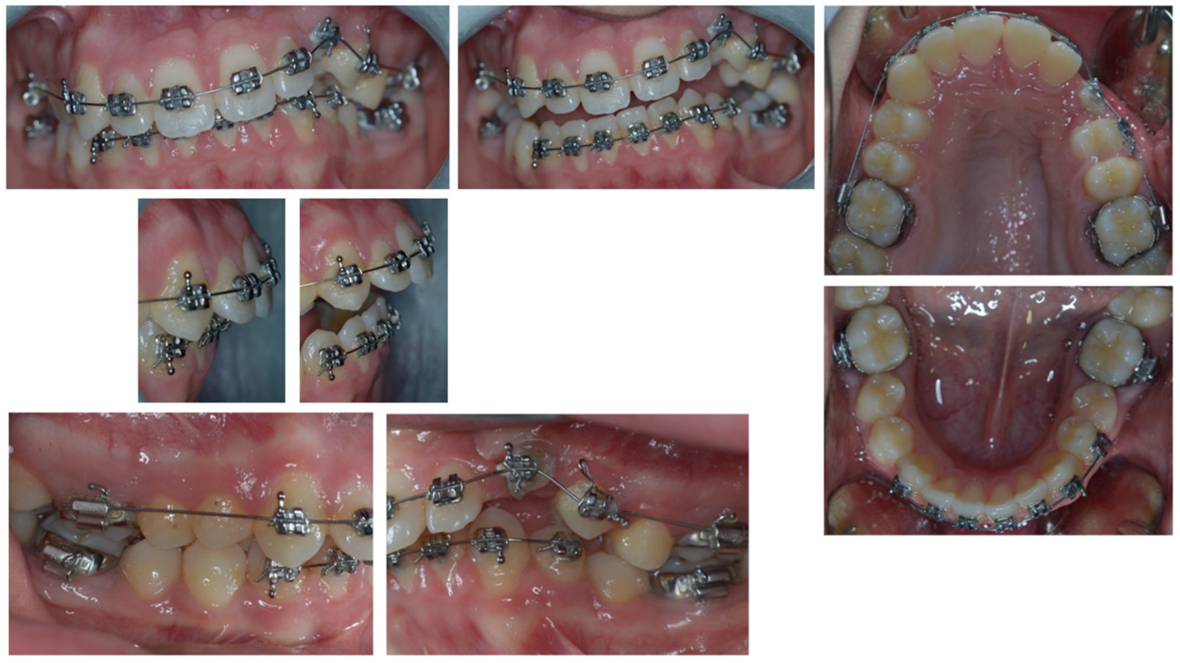 Dentistry 11 00278 g001