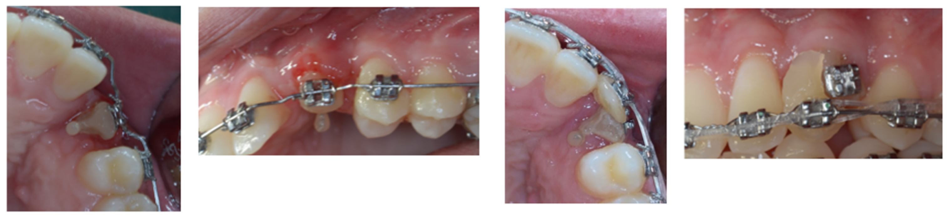 Dentistry 11 00278 g011