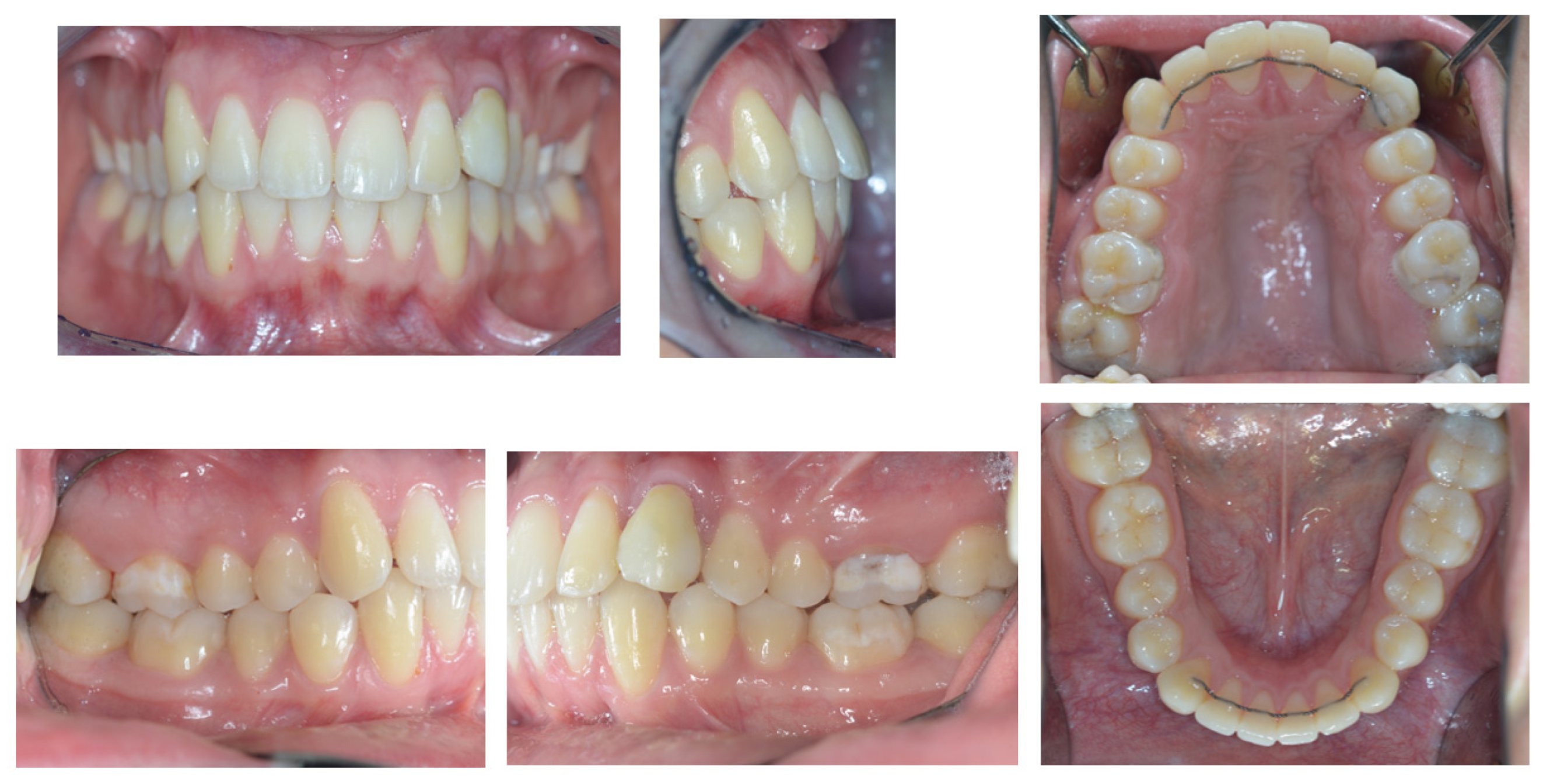 Dentistry 11 00278 g013