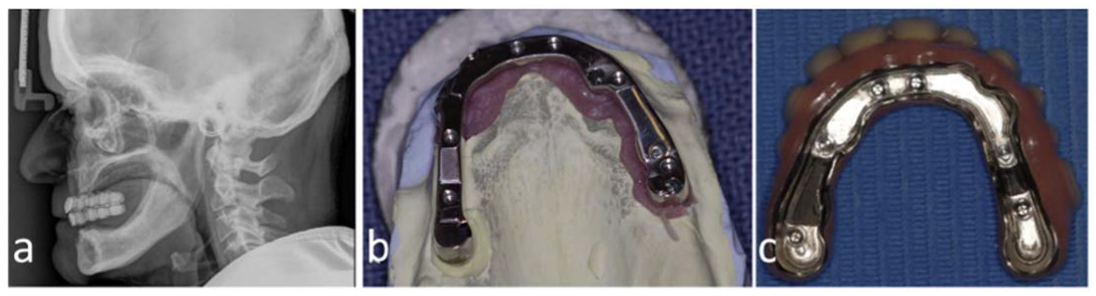 Dentistry 11 00289 g001