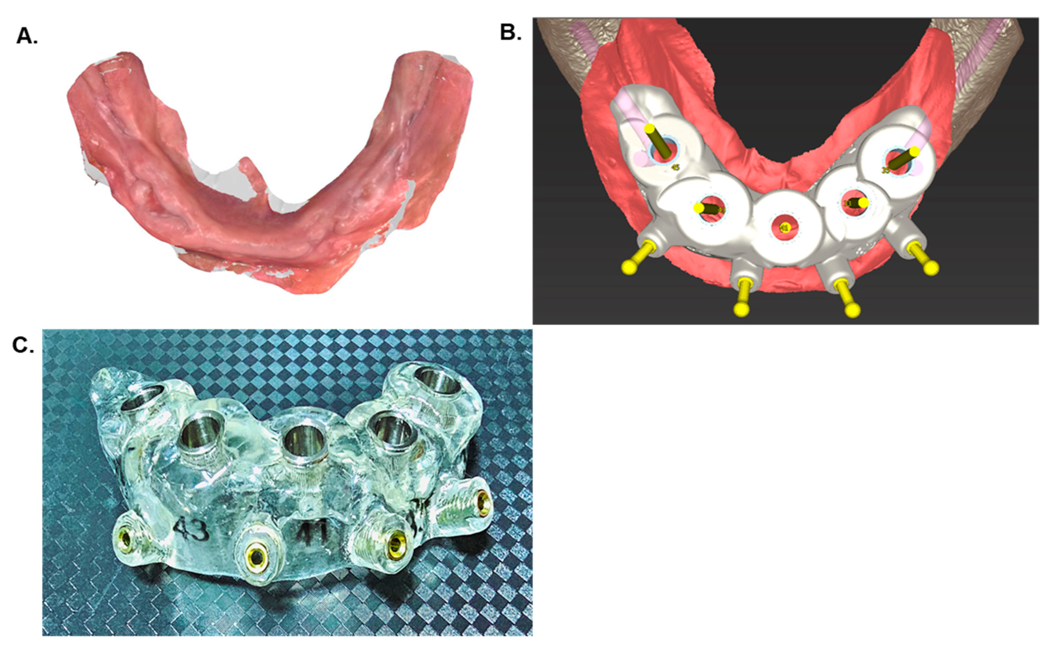 Dentistry 12 00008 g003