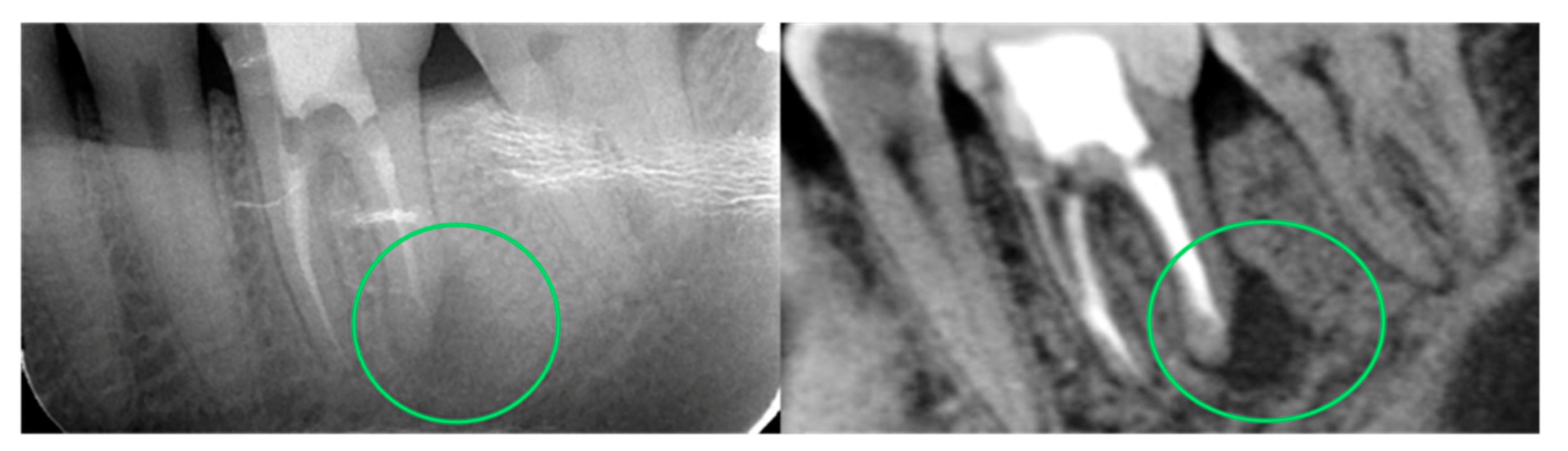 Dentistry 12 00008 g006