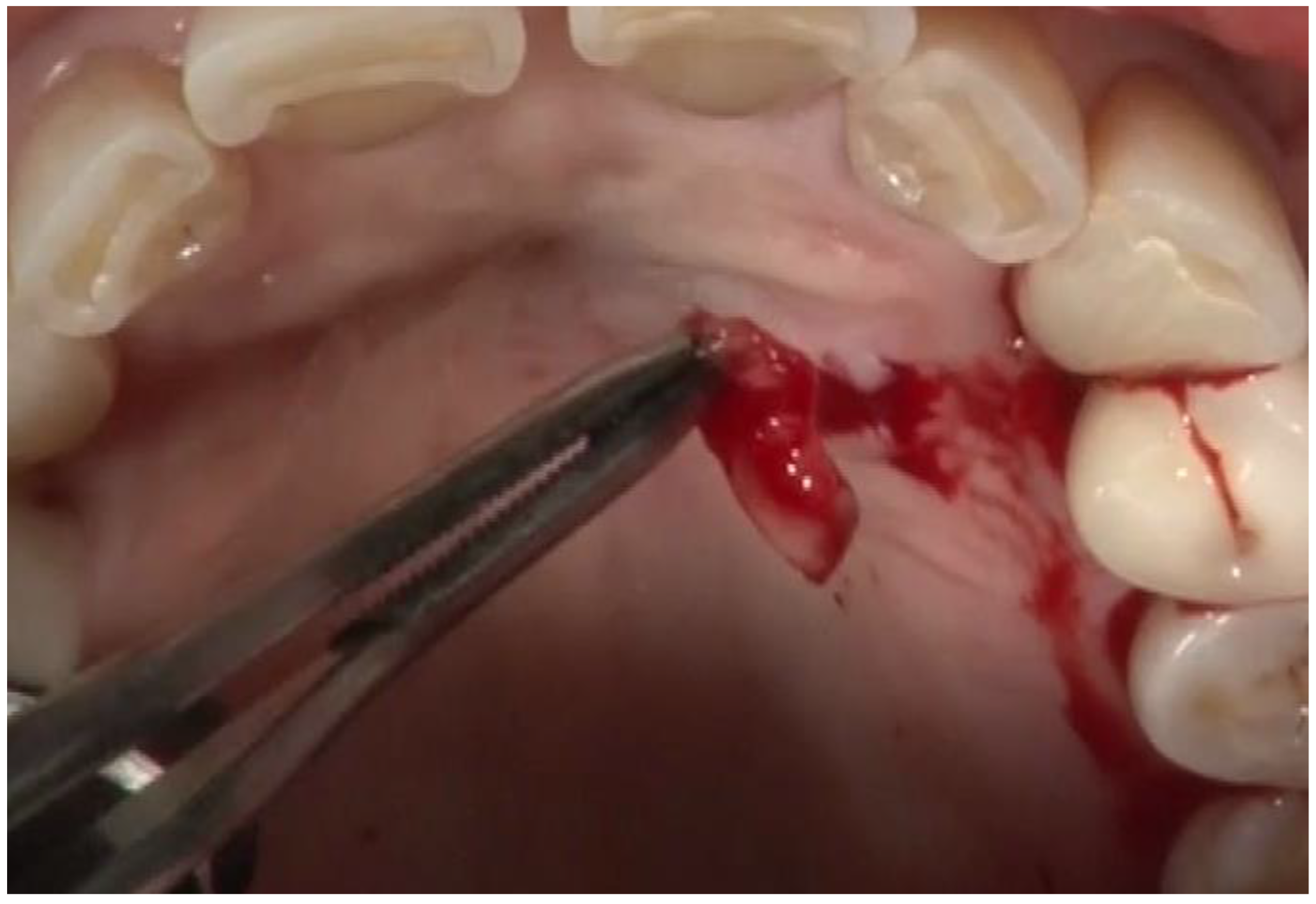 Dentistry 12 00011 g002