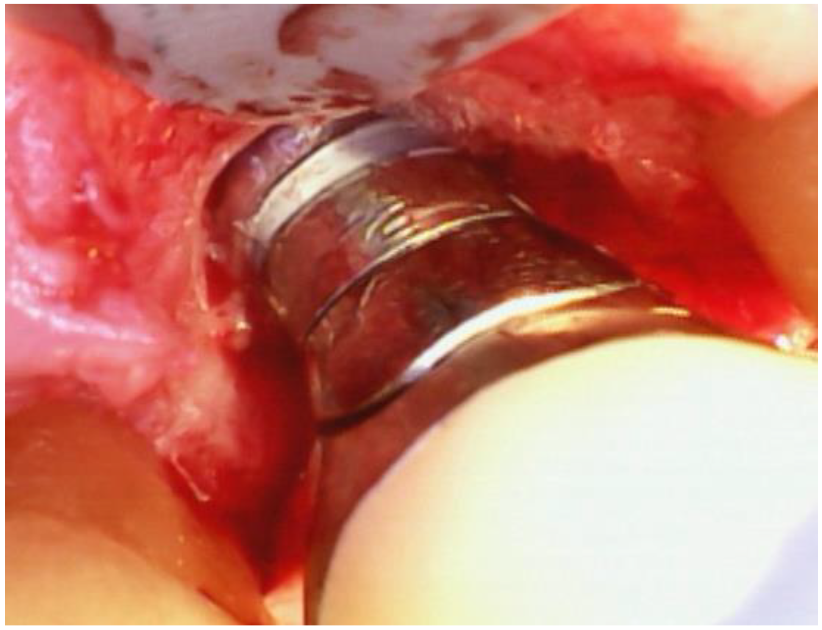 Dentistry 12 00011 g003