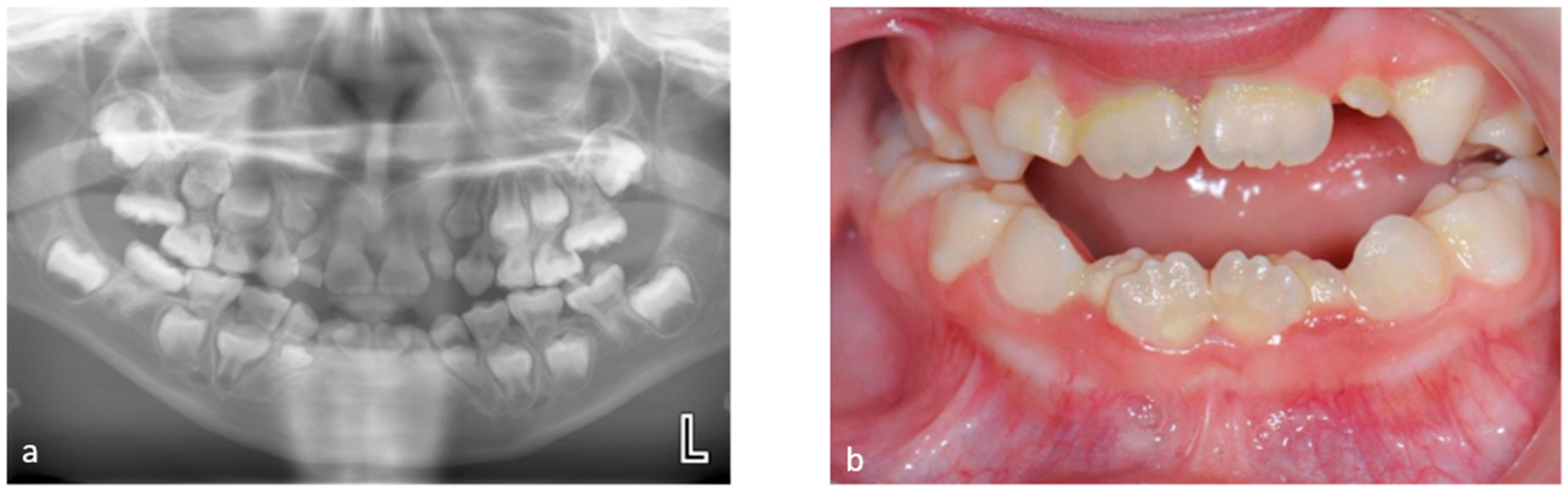 Dentistry 12 00017 g001 Dentistry 12 00017 g001