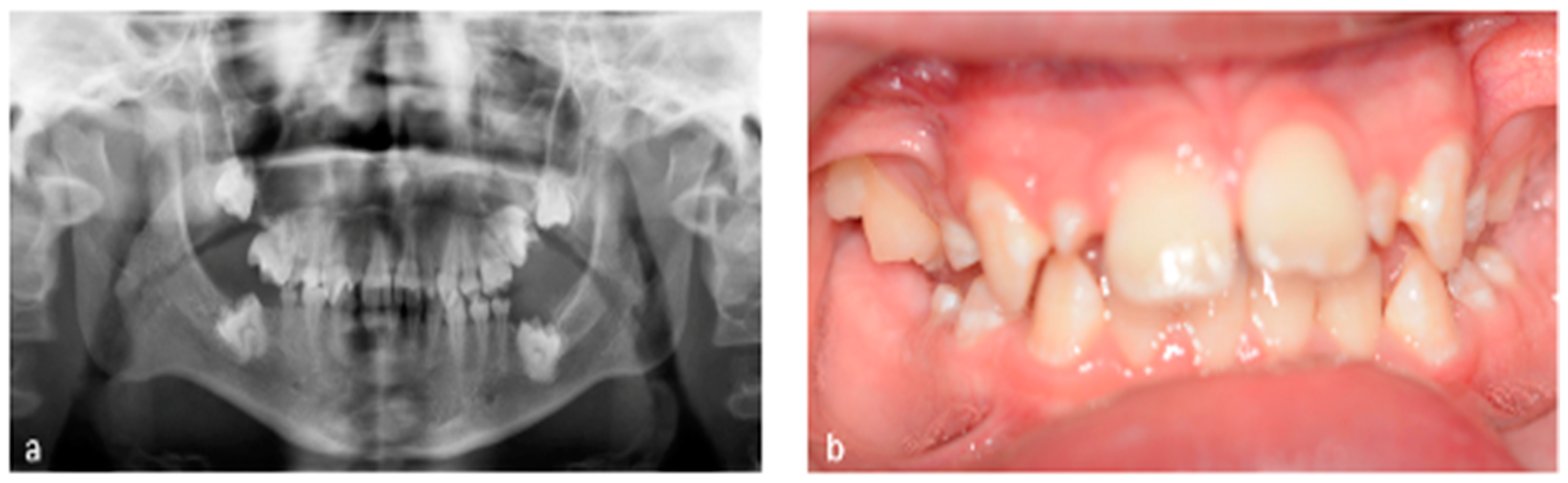 Dentistry 12 00017 g002 Dentistry 12 00017 g002