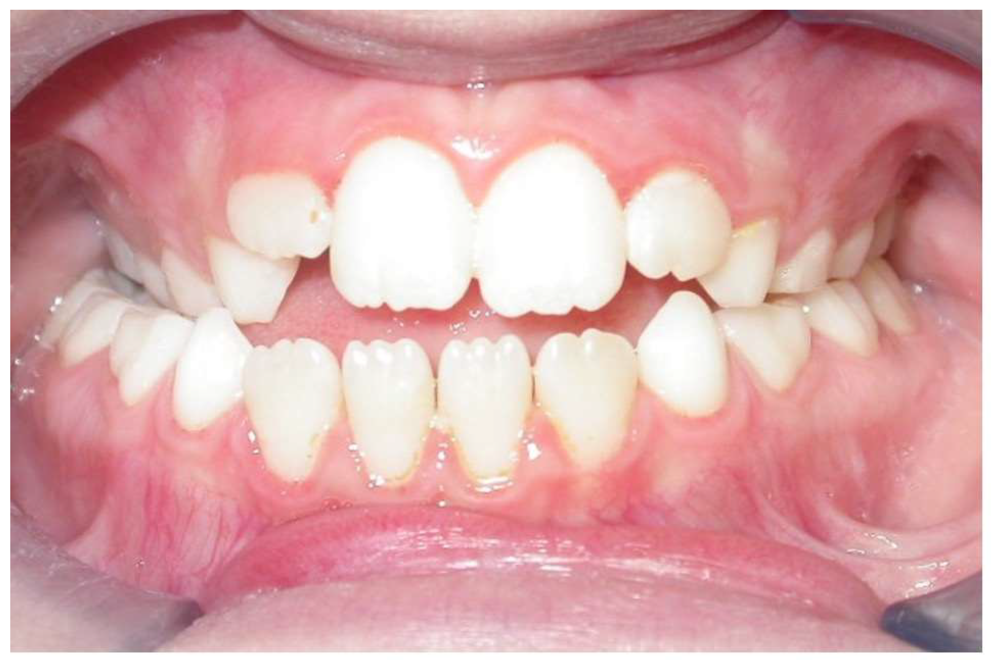 Dentistry 12 00022 g001 Dentistry 12 00022 g001