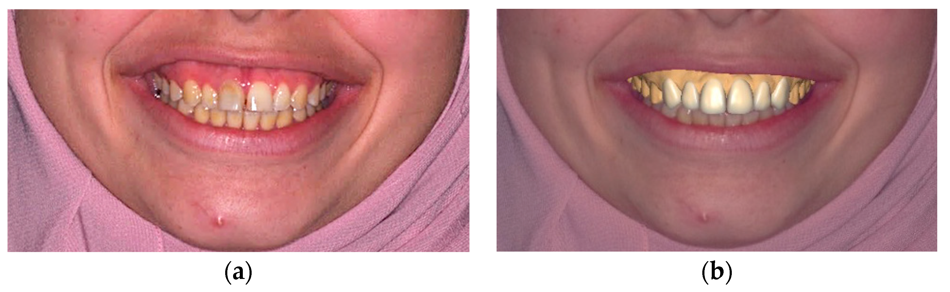 Dentistry 12 00028 g002