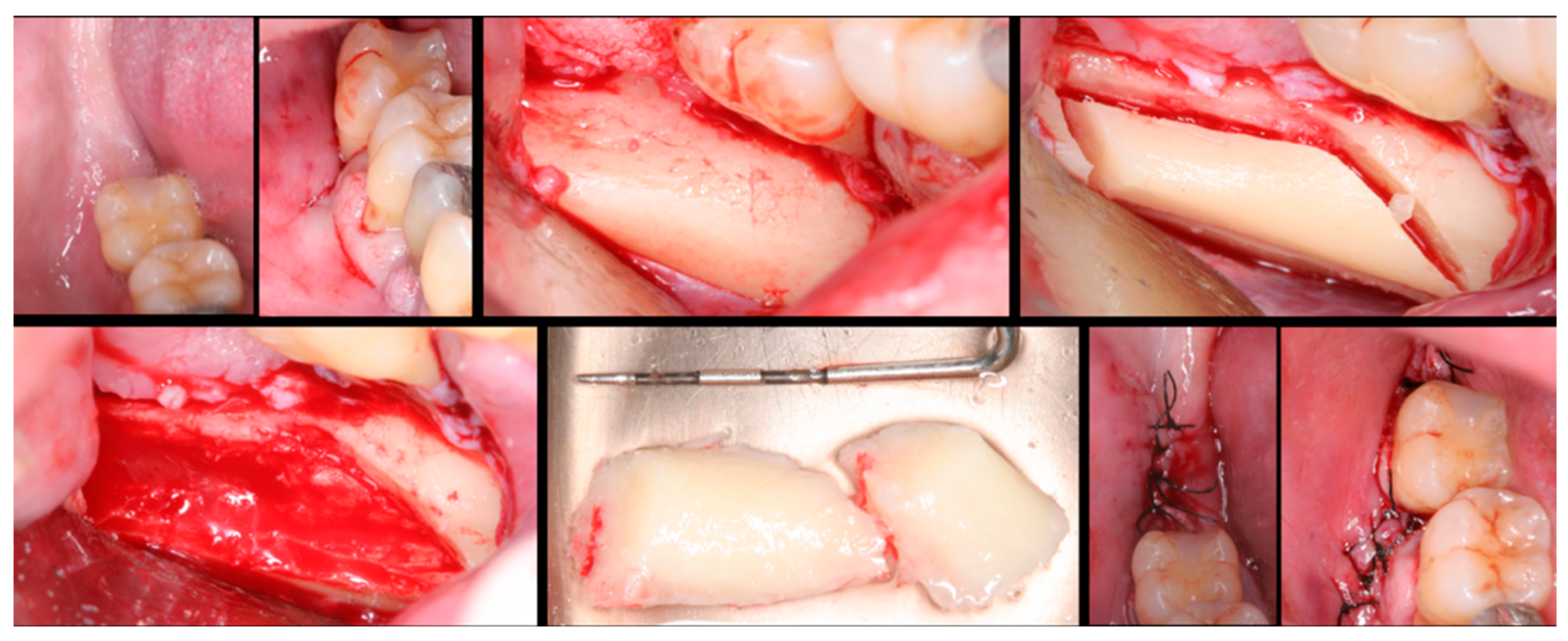 Dentistry 12 00033 g001