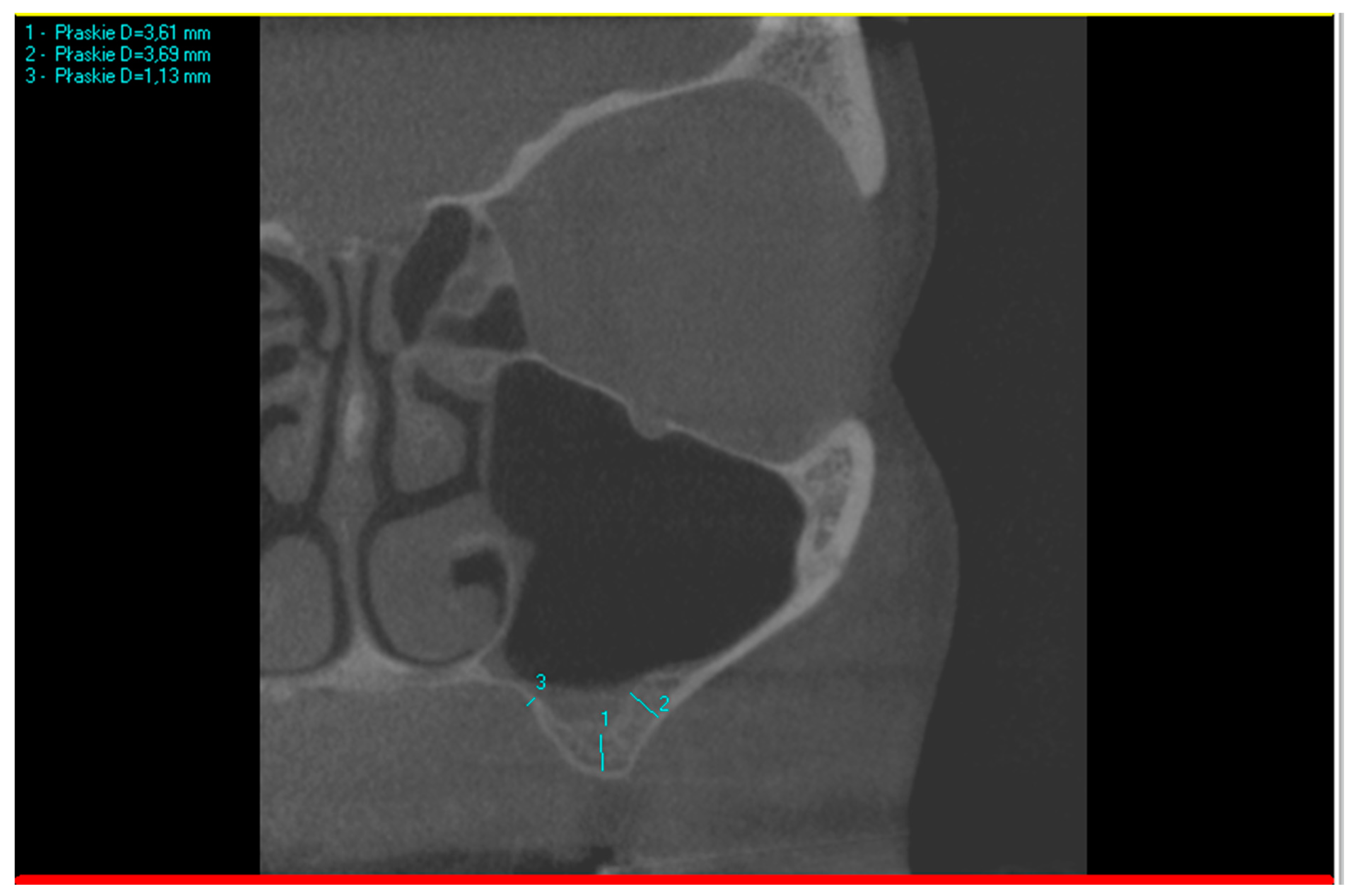 Dentistry 12 00035 g001