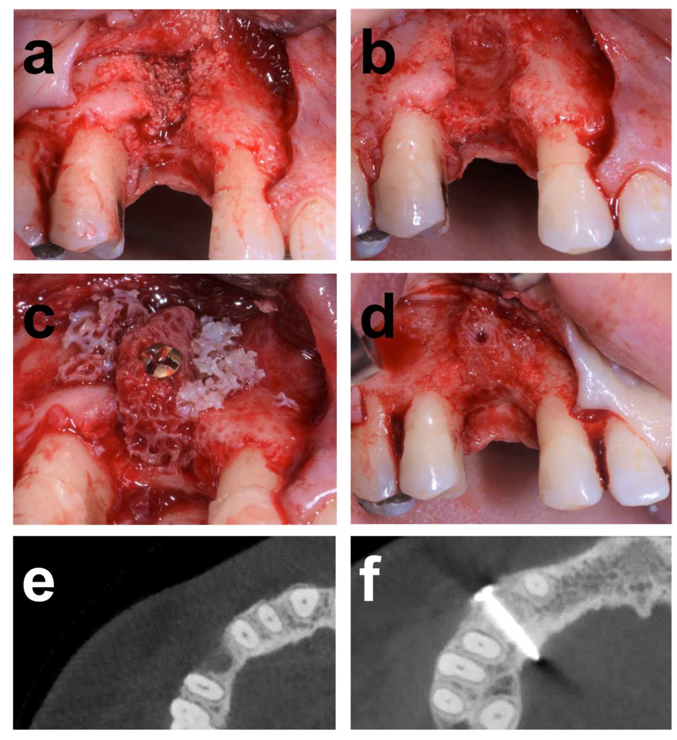 Dentistry 12 00042 g001