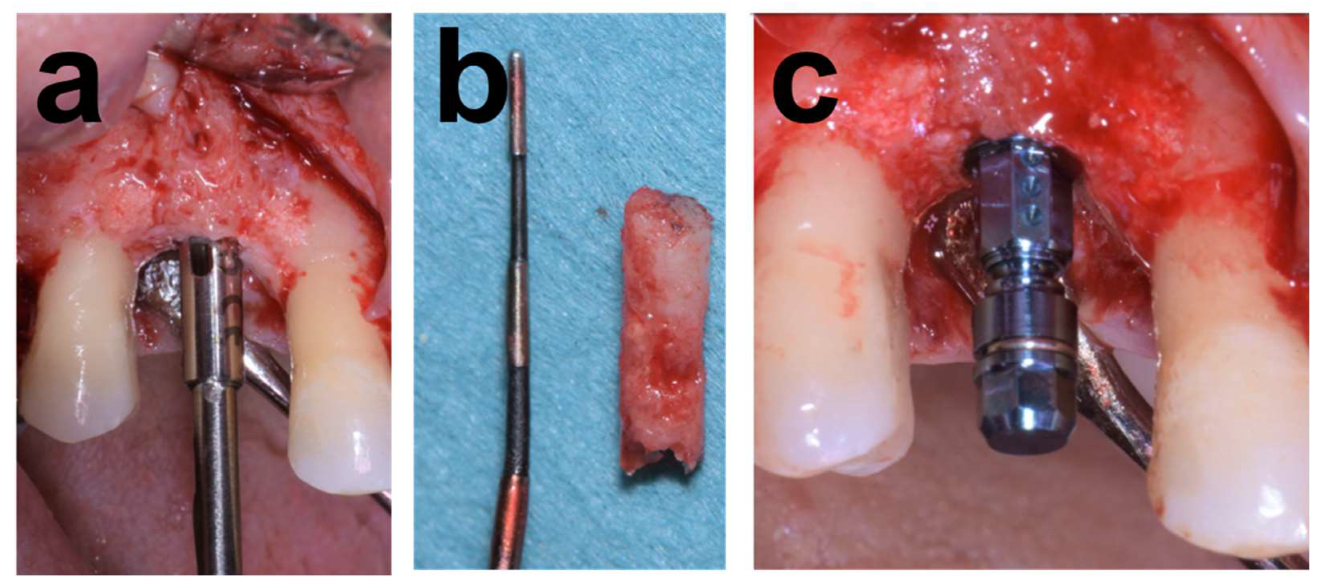 Dentistry 12 00042 g002