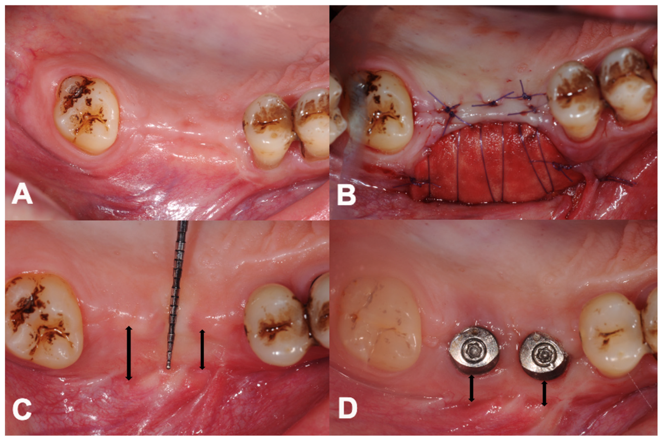 Dentistry 12 00043 g002