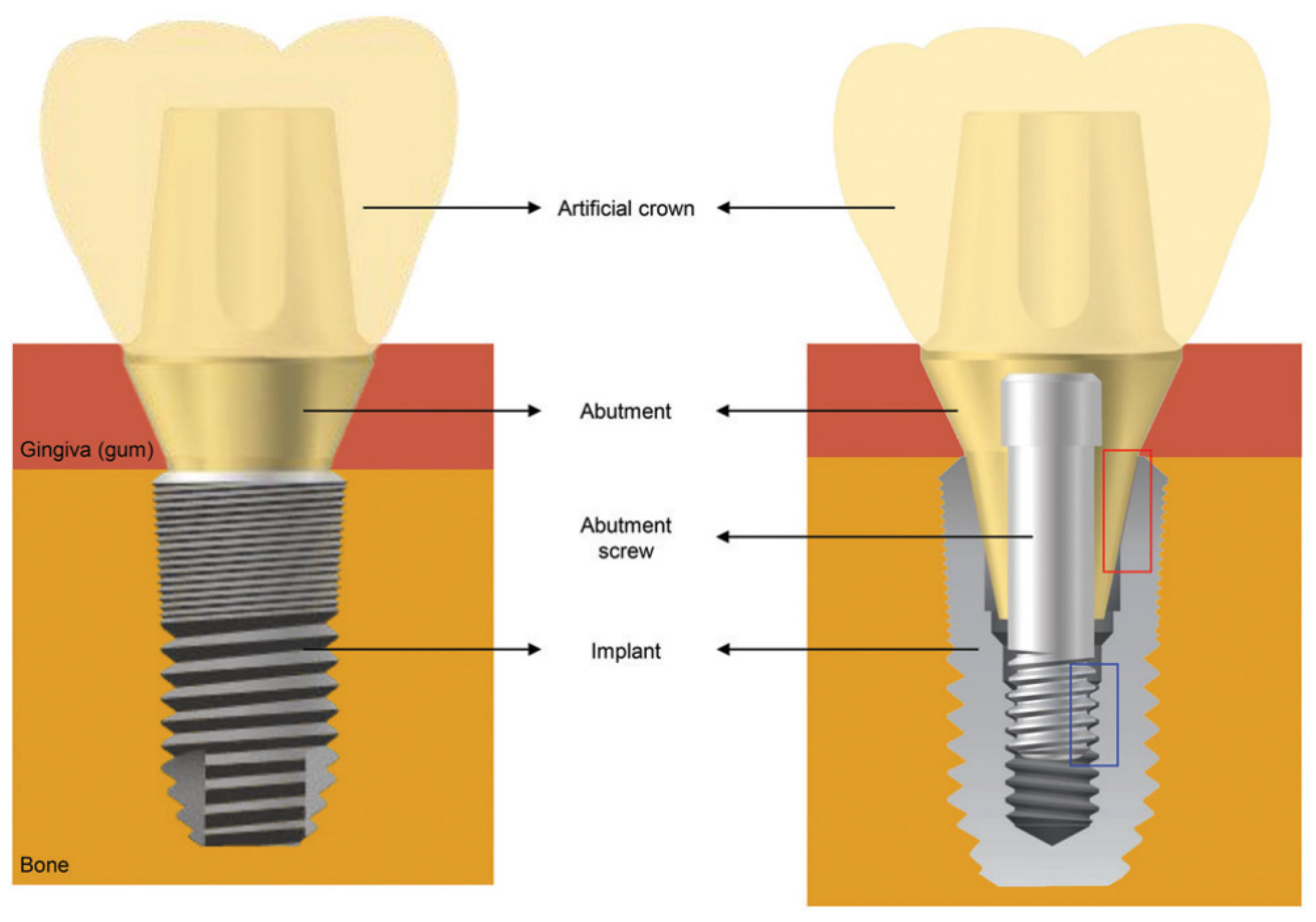 Dentistry 12 00047 g001 Dentistry 12 00047 g001