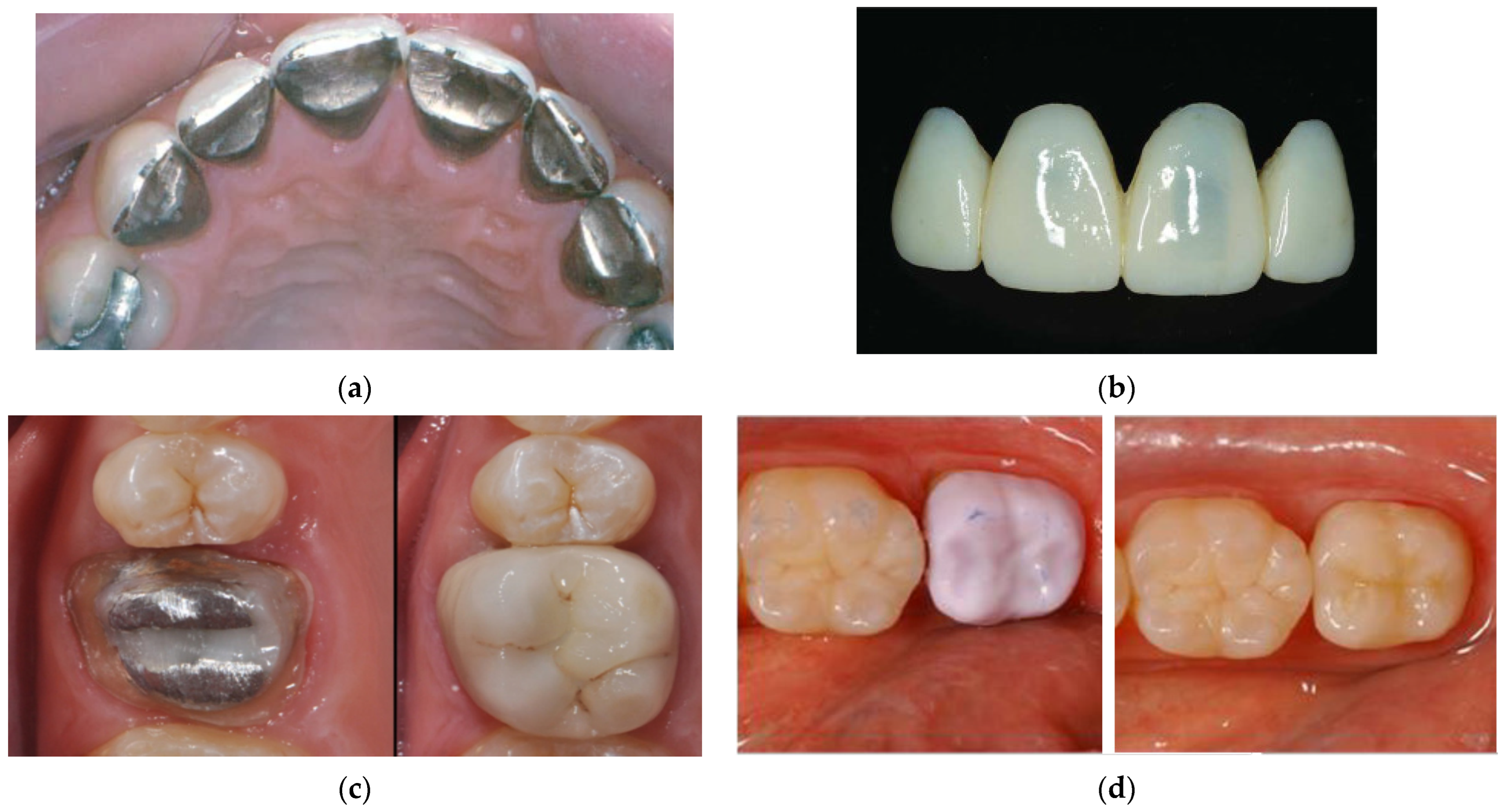Dentistry 12 00047 g003 Dentistry 12 00047 g003