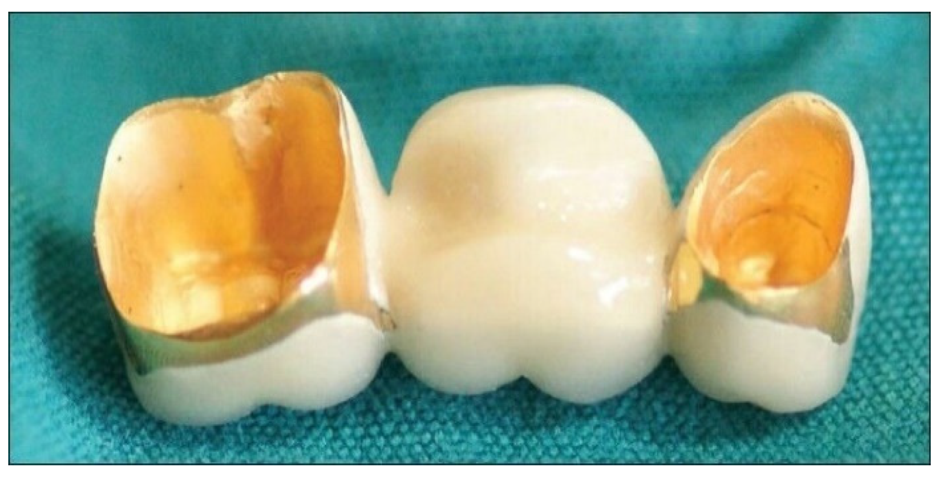 Dentistry 12 00047 g004 Dentistry 12 00047 g004